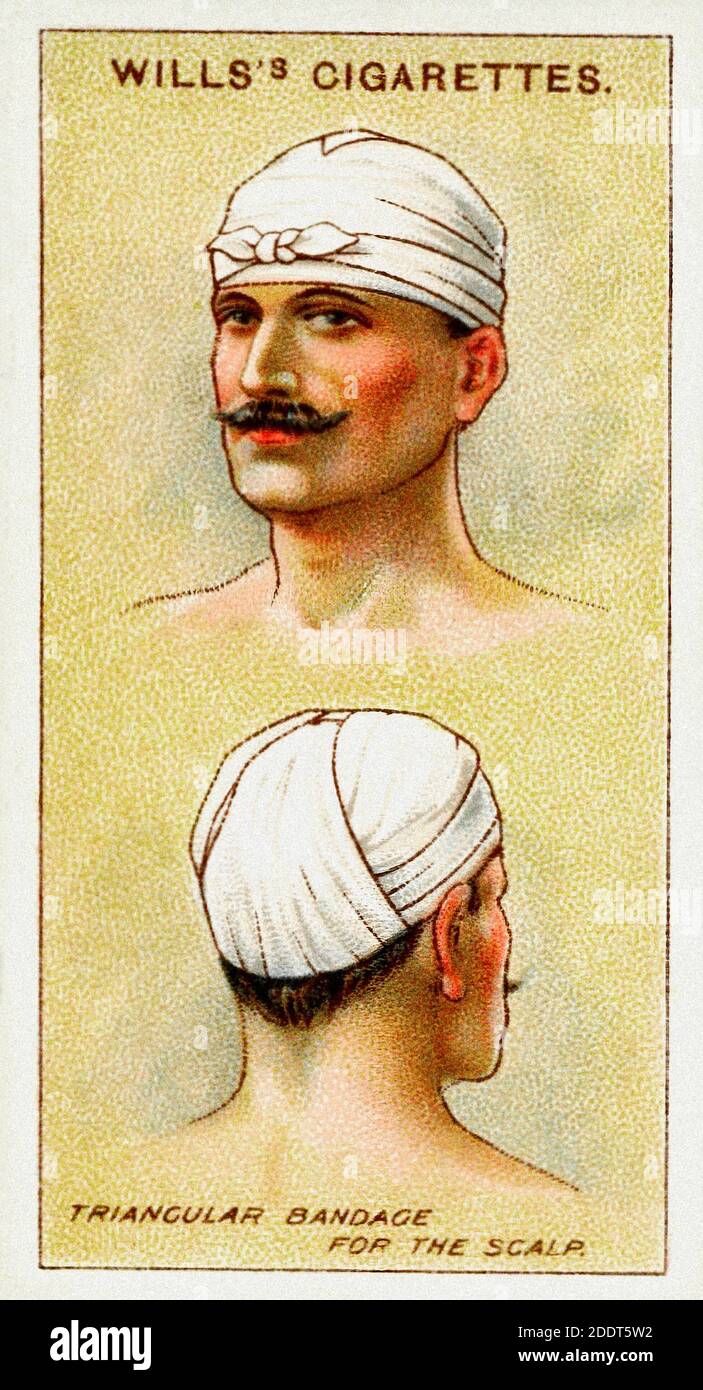Carte di sigarette antiche. Sigarette di Wills (serie di pronto soccorso ). Bendaggio triangolare per il cuoio capelluto. Inghilterra. 1913 Foto Stock