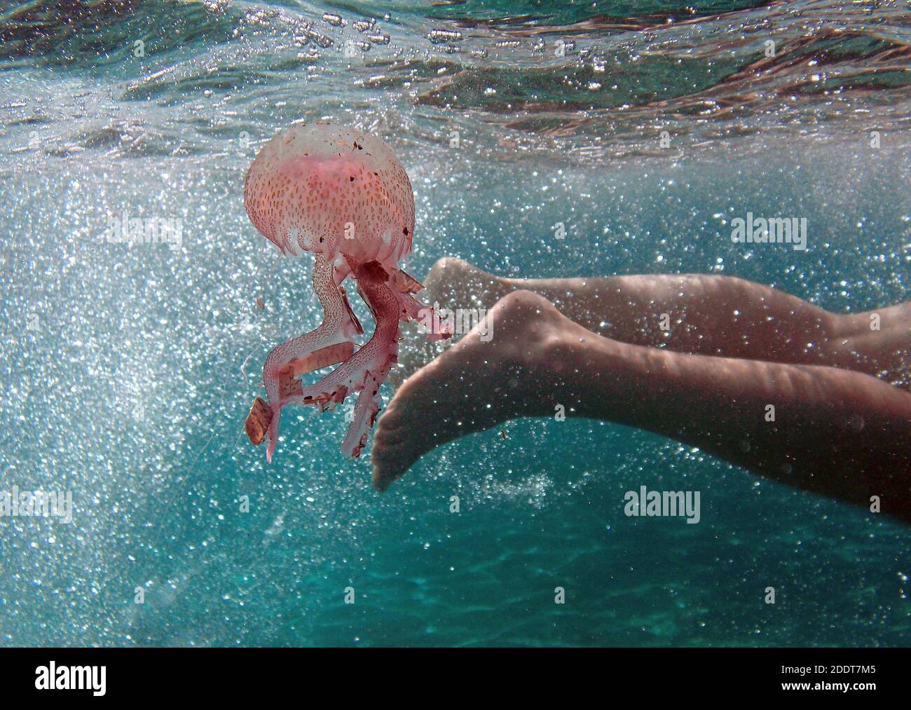una persona che nuota in mare accidentalmente tocca una medusa Foto Stock