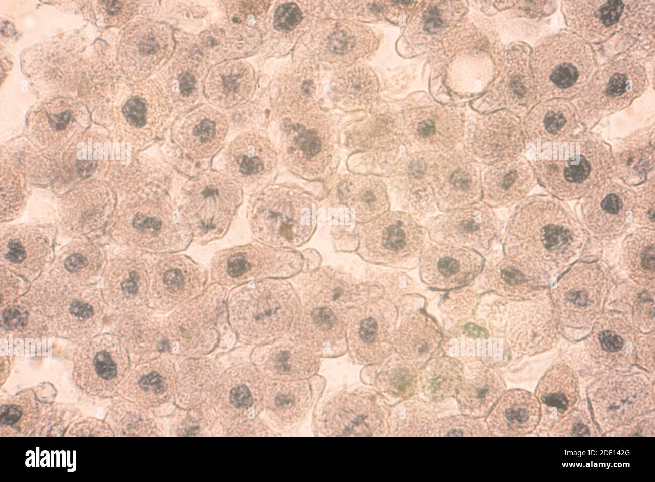 Cellule Epiteliali Squamose Immagini e Fotos Stock - Alamy
