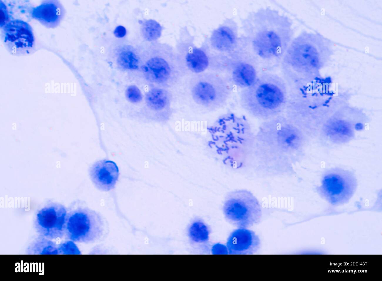 La mitosi, micrografia di luce Foto Stock