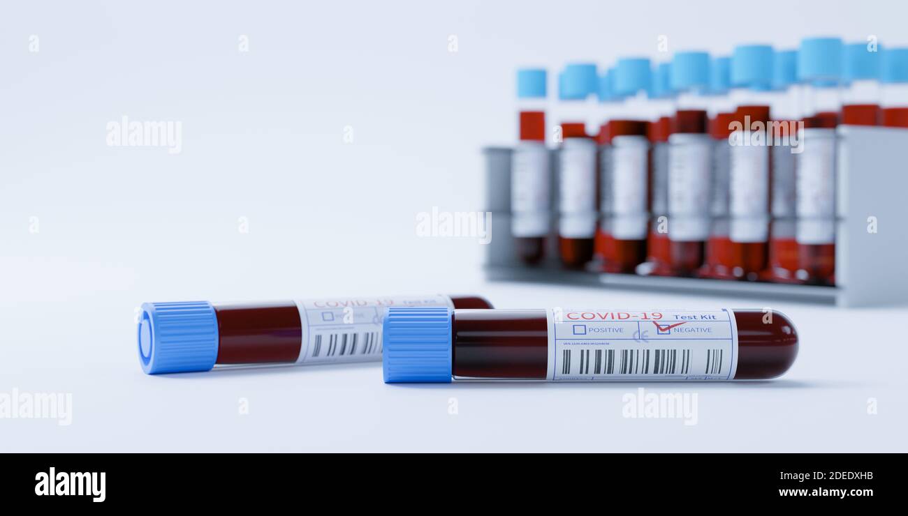 Provette per test Coronavirus Covid19 in rack. Screening medico e test Covid produzione rendering 3d Foto Stock