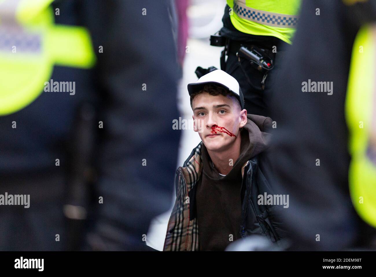 Protesta anti-lock-down, Oxford Street, Londra, 28 novembre 2020. Un protestante arrestato con sangue siede sul marciapiede circondato dalla polizia. Foto Stock
