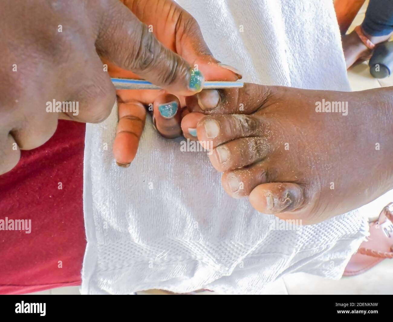 Limatura toenails. Foto Stock