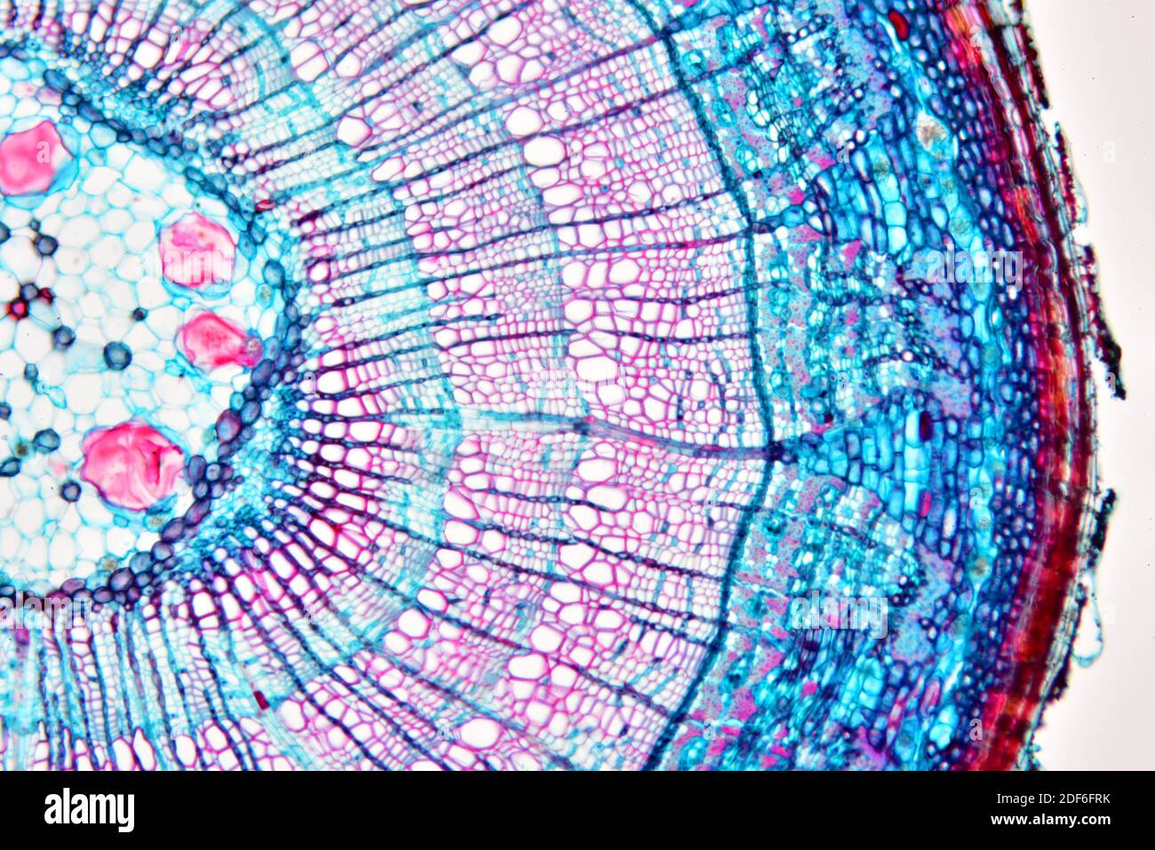 Stelo Eudicot (Ranunculus sp. ) che mostra epidermide, collenchimia, corteccia, parenchimia, pith, floem e xilema. Microscopio ottico X100. Foto Stock