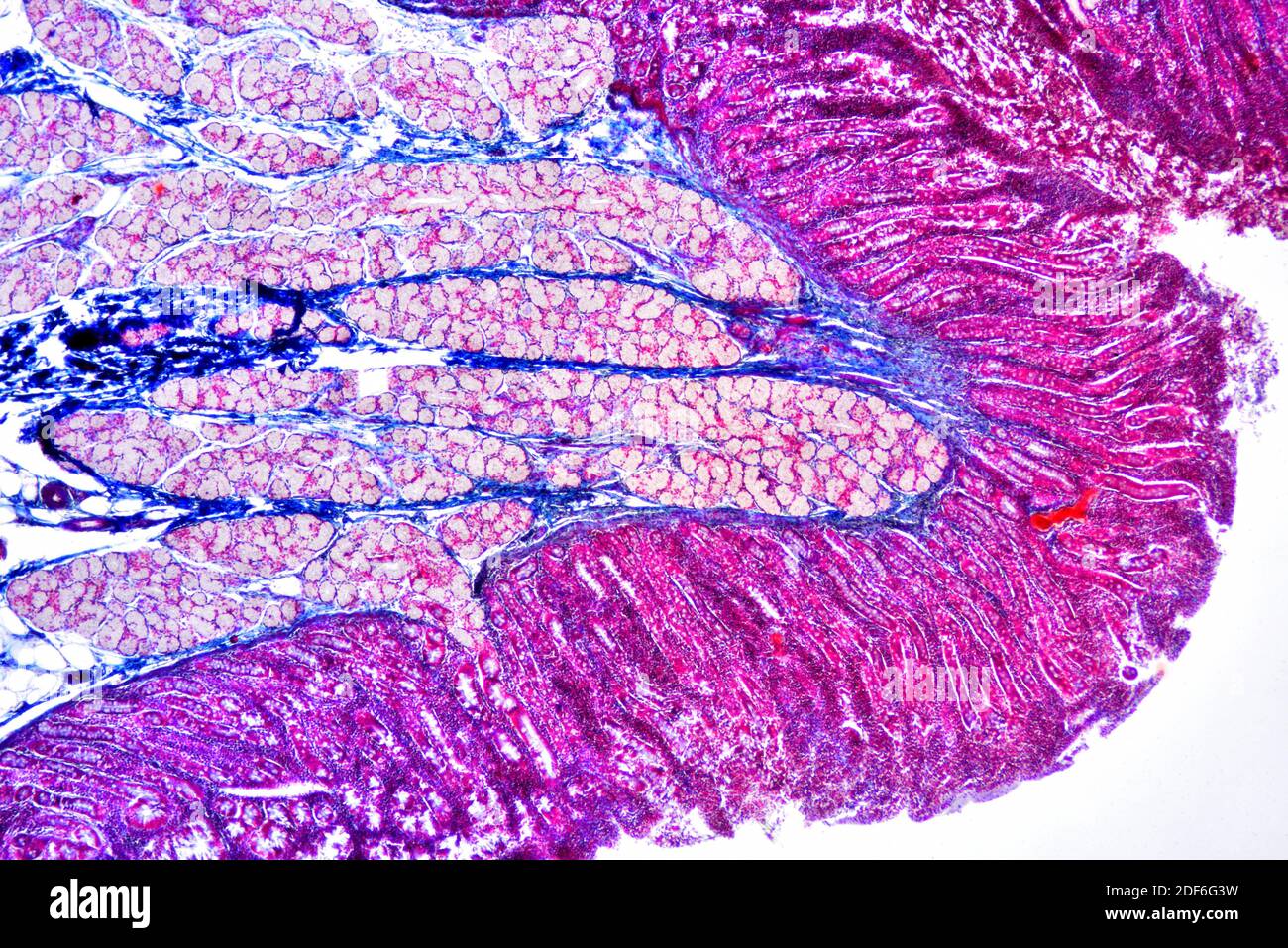 Duodeno umano (intestino tenue) che mostra mucosa villosa, sottomucosa, ghiandole Brunner e ghiandole duodenali. Microscopio ottico X40. Foto Stock