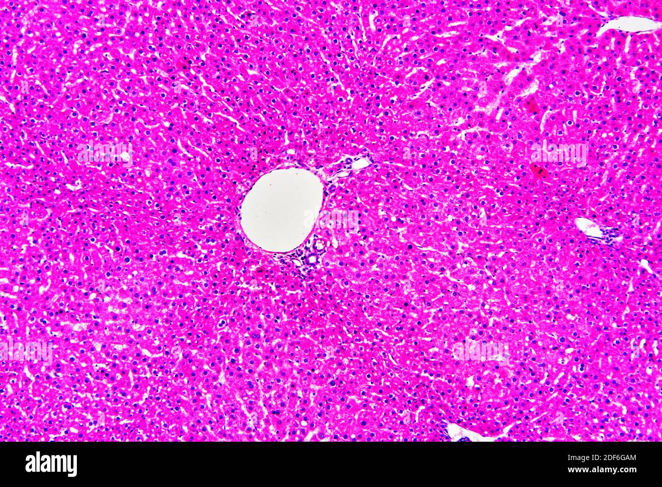Fegato umano sano o normale con epatociti e vasi sanguigni. Microscopio ottico X100. Foto Stock