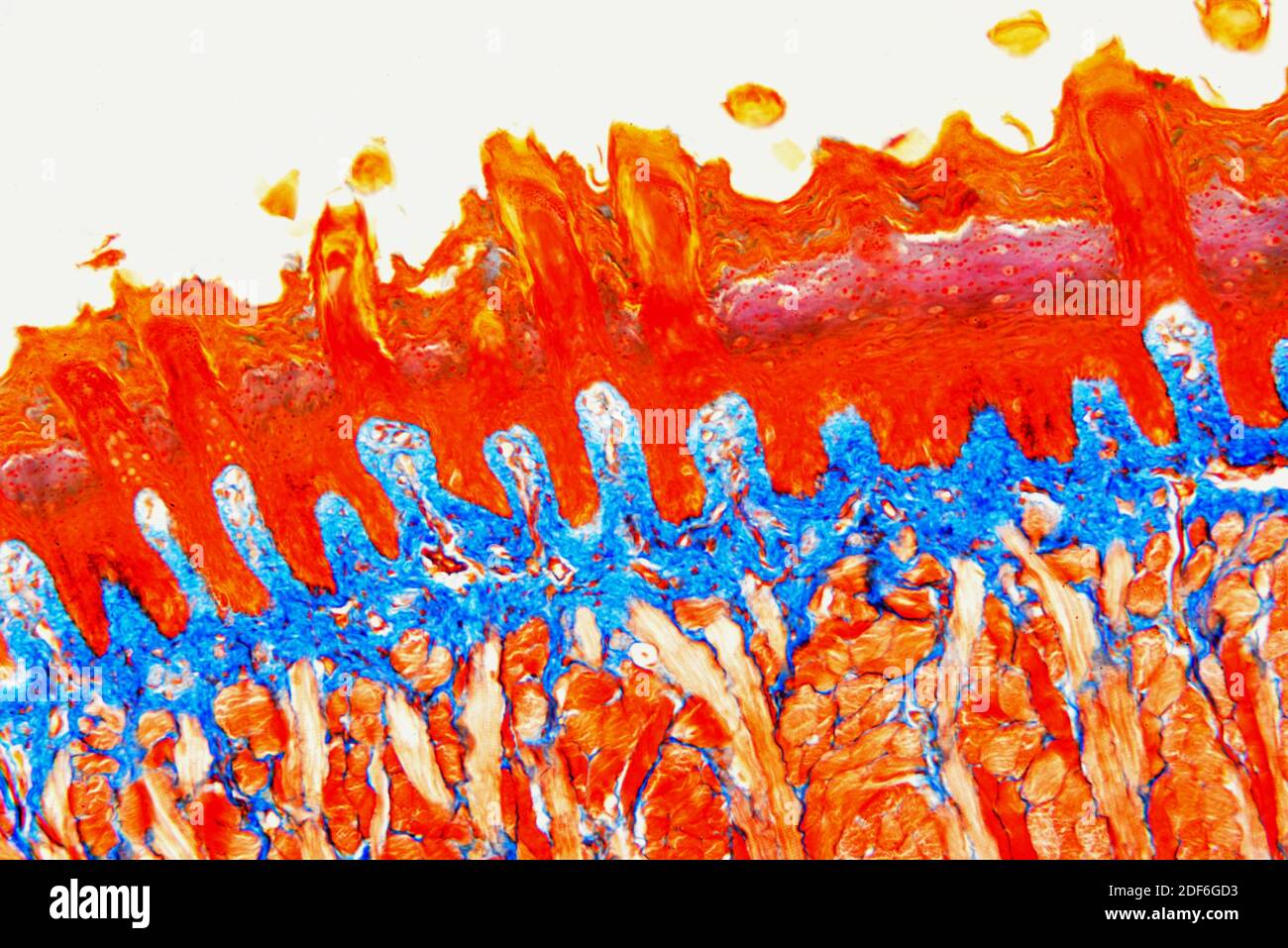 Sezione della lingua che mostra papille linguali, papille gustative, muscoli striati e tessuto connettivo. Microscopio ottico X100. Foto Stock