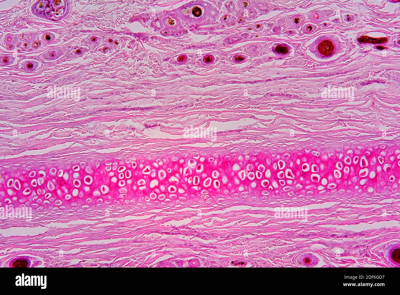 Tessuto cartilagineo elastico dall'orecchio che mostra condrociti, fibre di  elastina e matrice. Microscopio ottico X100 Foto stock - Alamy