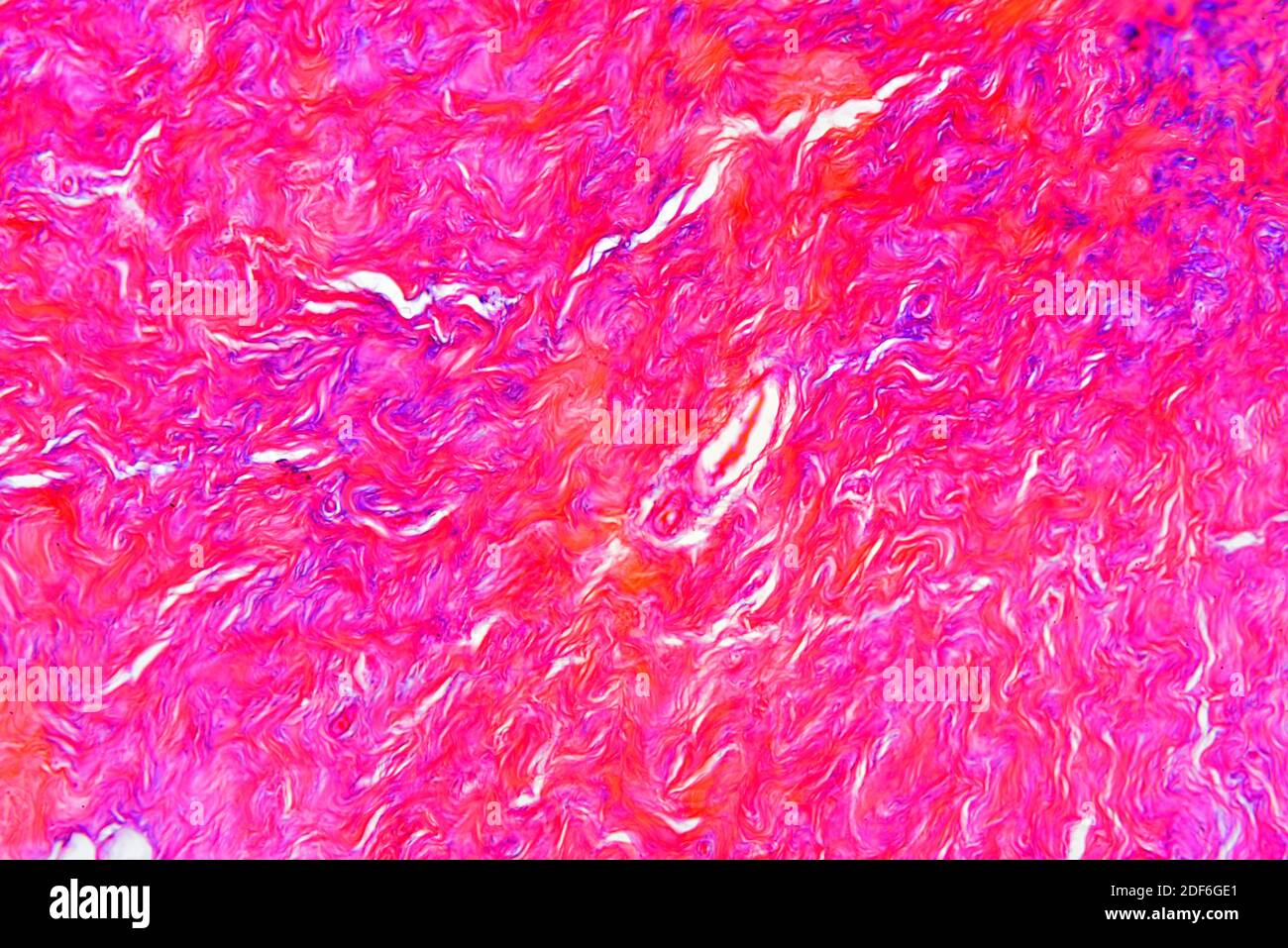Tessuto di fibrocartilagine che mostra fibre di collagene. Microscopio  ottico X100 Foto stock - Alamy