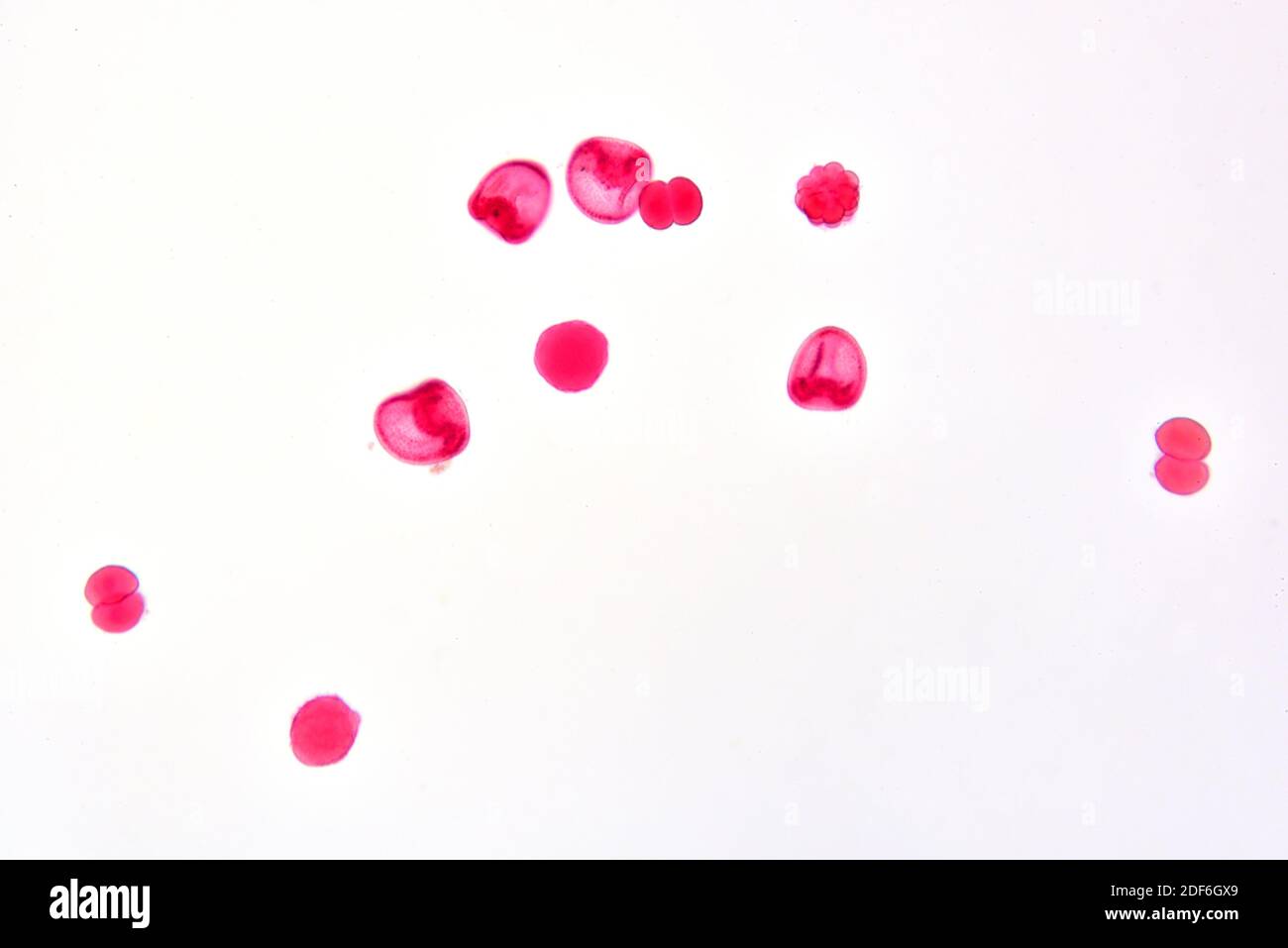 Ricci di mare, blastula, gastrula e morula. Microscopio ottico X100 Foto  stock - Alamy