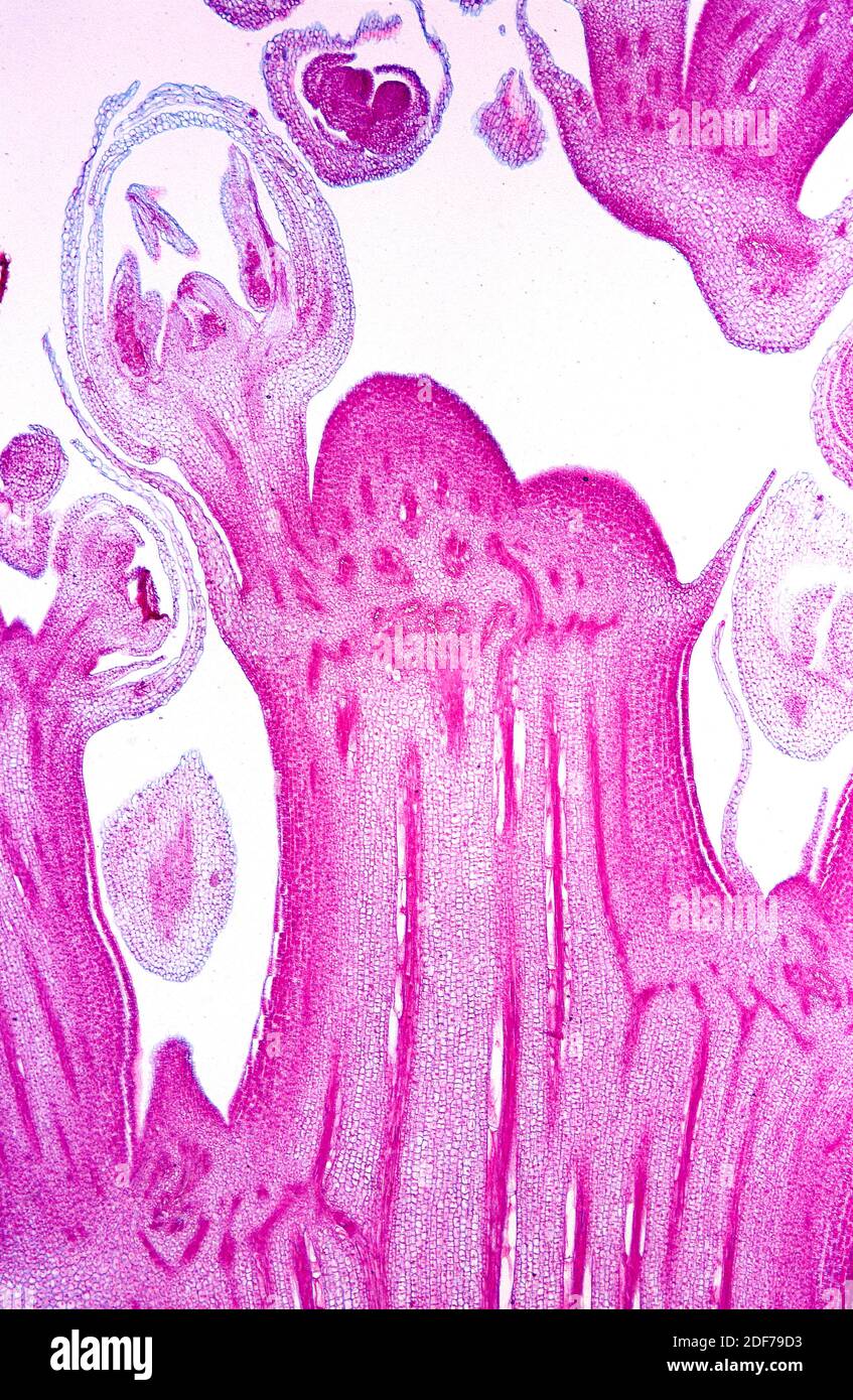 Germoglio apicale di asparagi con tessuto meristematico, sezione longitudinale. Fotomicrografia. Foto Stock
