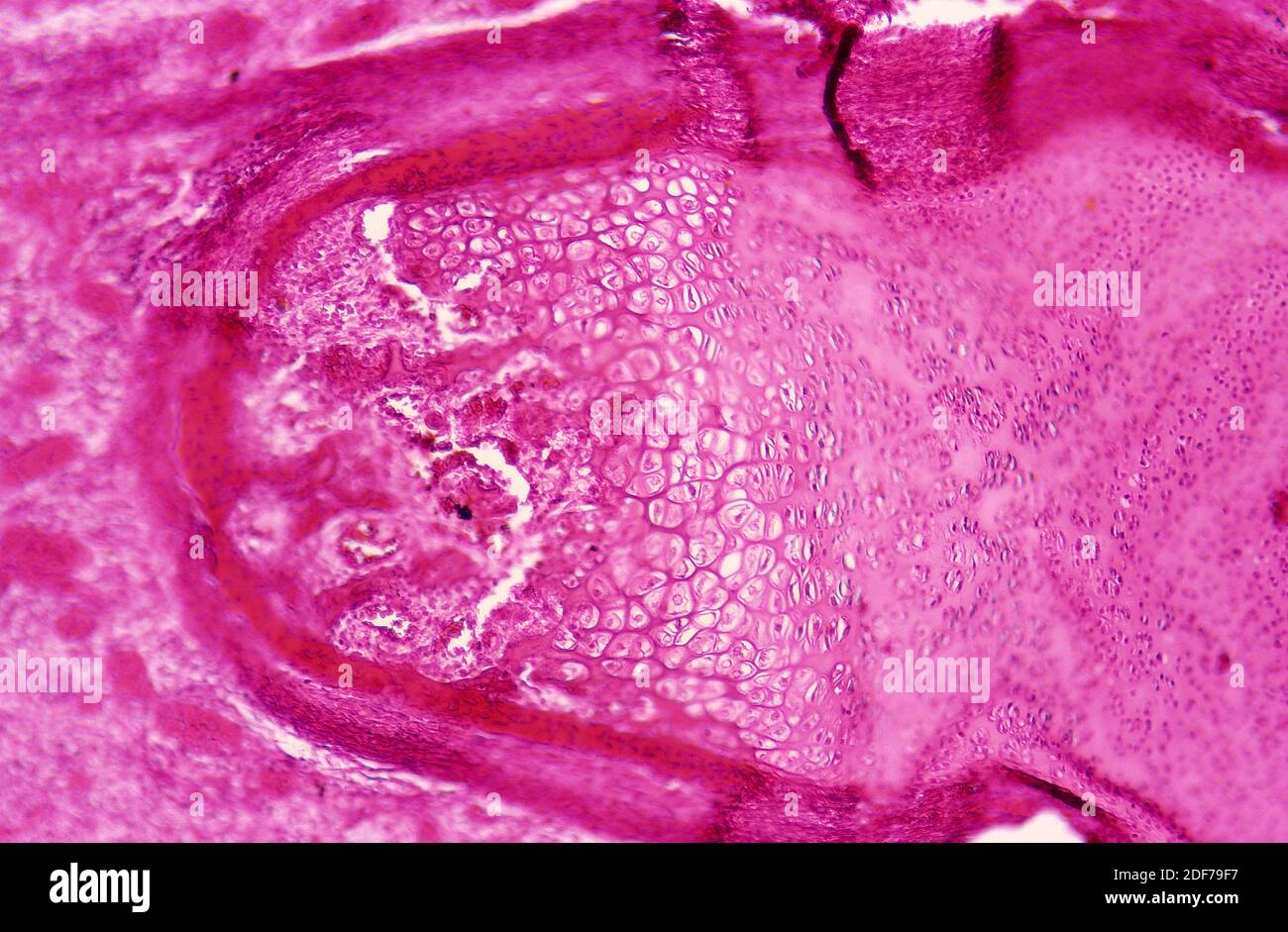 Cartilagine nel dito fetale. Fotomicrografia. Foto Stock