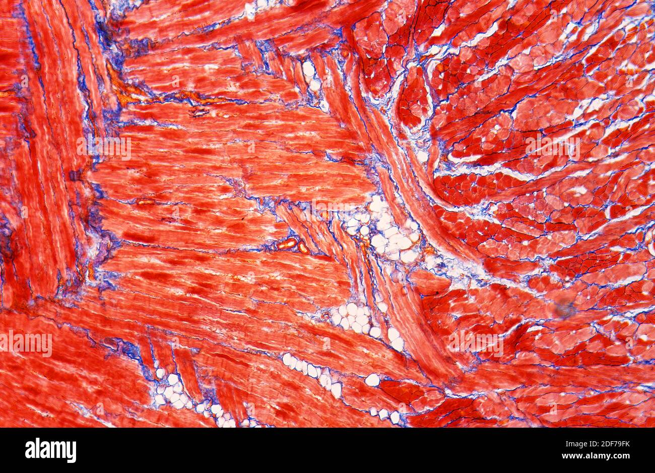 Muscolo scheletrico con sezioni trasversali e longitudinali sulla lingua. Fotomicrografia. Foto Stock