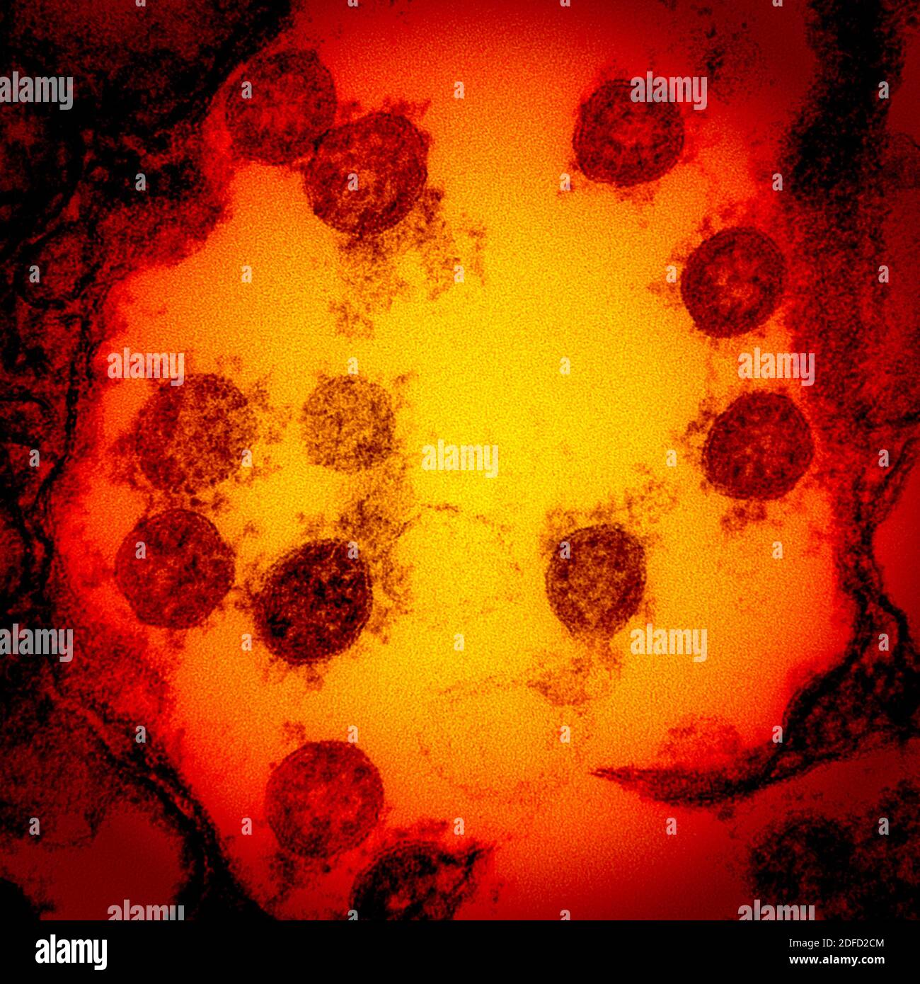 Micrografia elettronica di trasmissione di particelle di virus SARS-COV-2, isolate da un paziente. Acquisizione di immagini e ottimizzazione del colore con le Res integrate NIAID Foto Stock