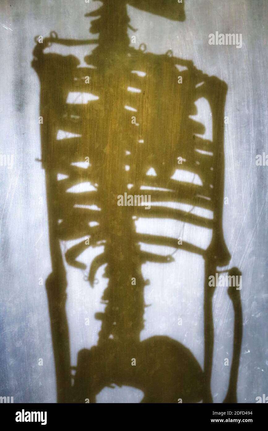 Ombra di uno scheletro umano Foto Stock