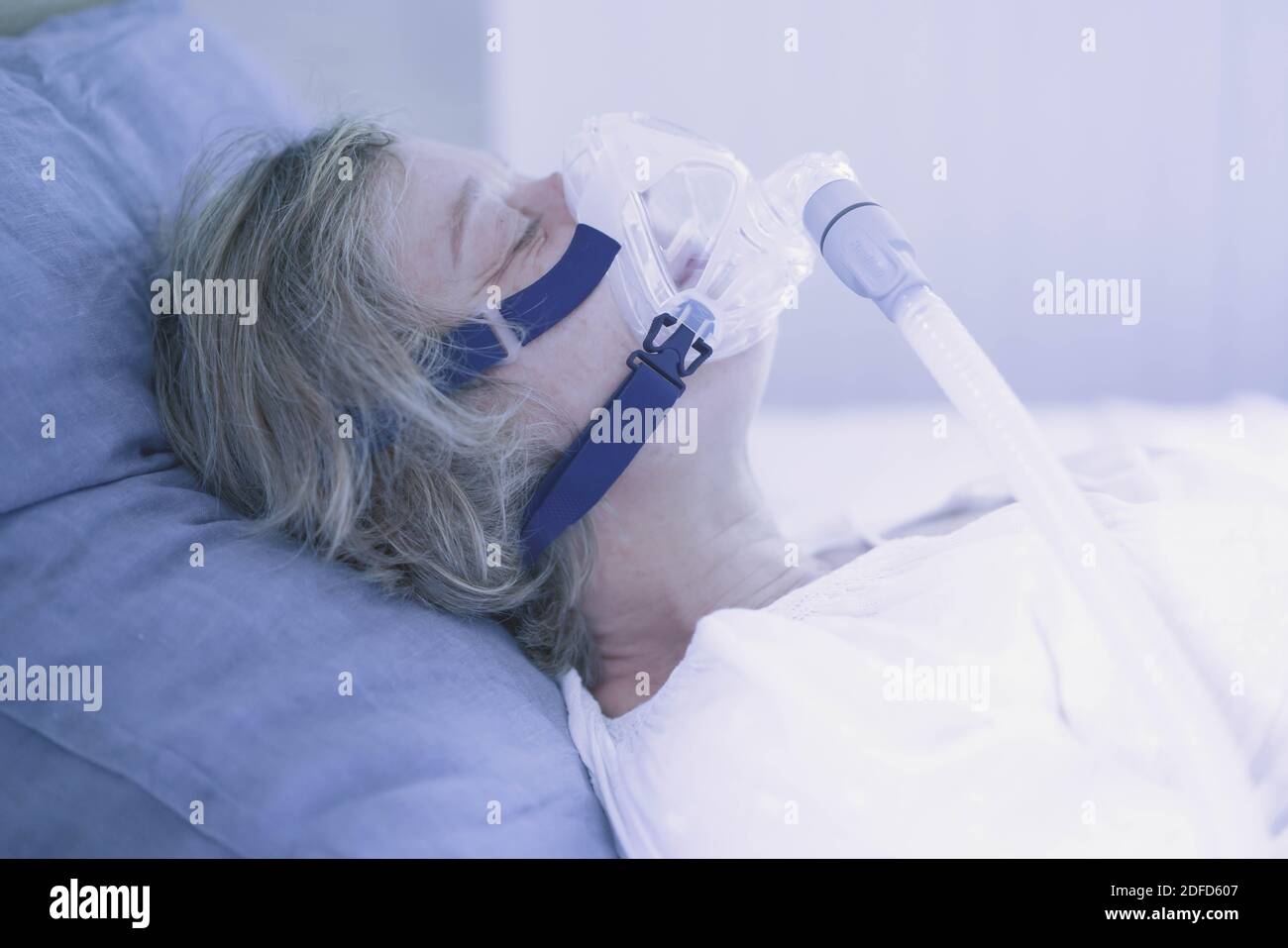 Trattamento dell'apnea nel sonno e del russamento : paziente affetto da sindrome ostruttiva dell'apnea nel sonno (OSAS) collegato a un pressu continuo positivo delle vie aeree Foto Stock