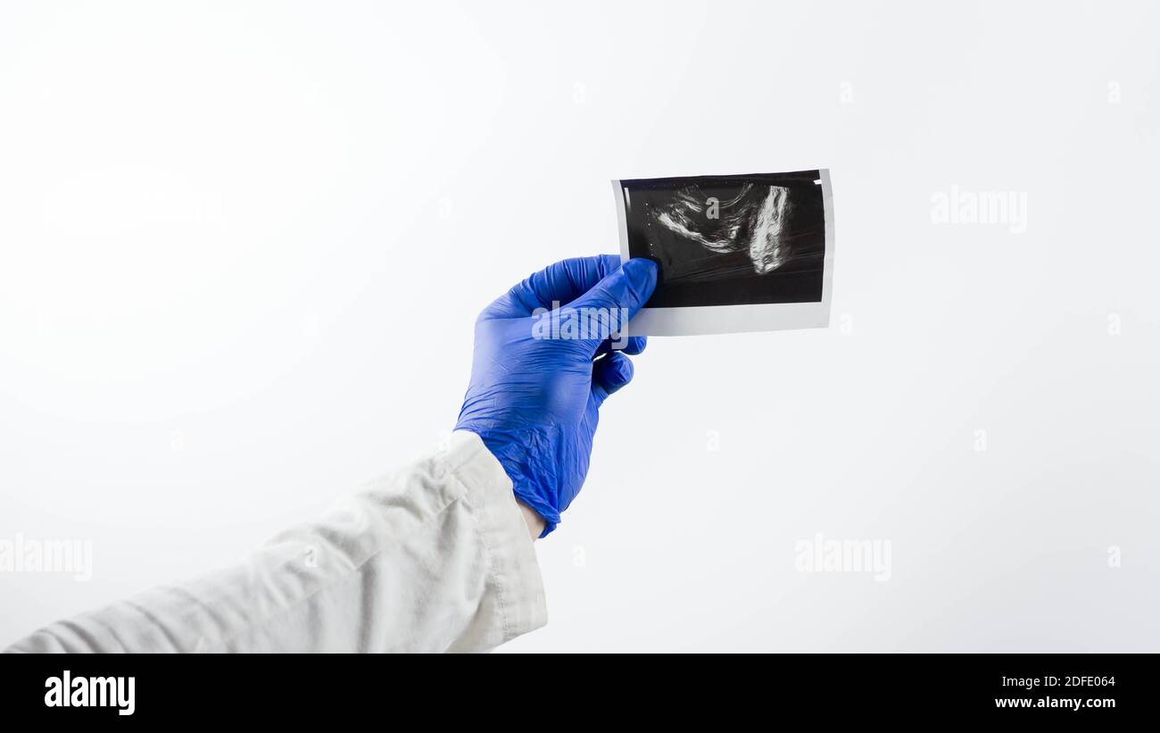 Il medico dimostra una radiografia della ghiandola prostatica maschile, per diagnosticare l'immagine radiografica della prostata, su uno sfondo bianco. Foto Stock