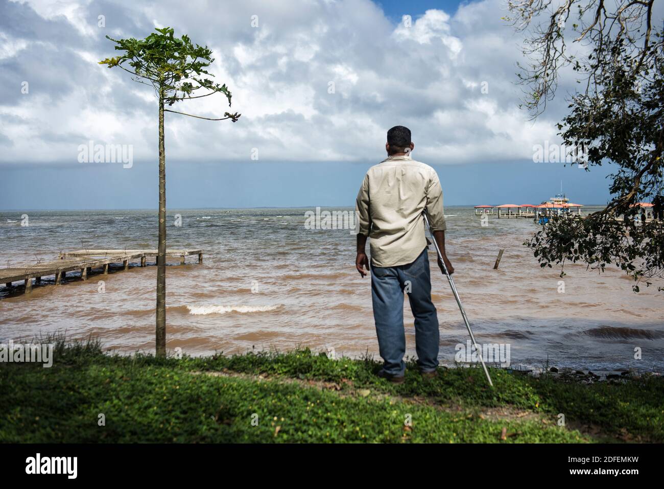 La persona disabile paralizzò dalla malattia di decompressione (DCS) a causa di intensa pesca di aragosta utilizzando i metodi di immersione subacquea guardando l'oceano. Puerto Lempira, Mosquitia, Honduras Foto Stock