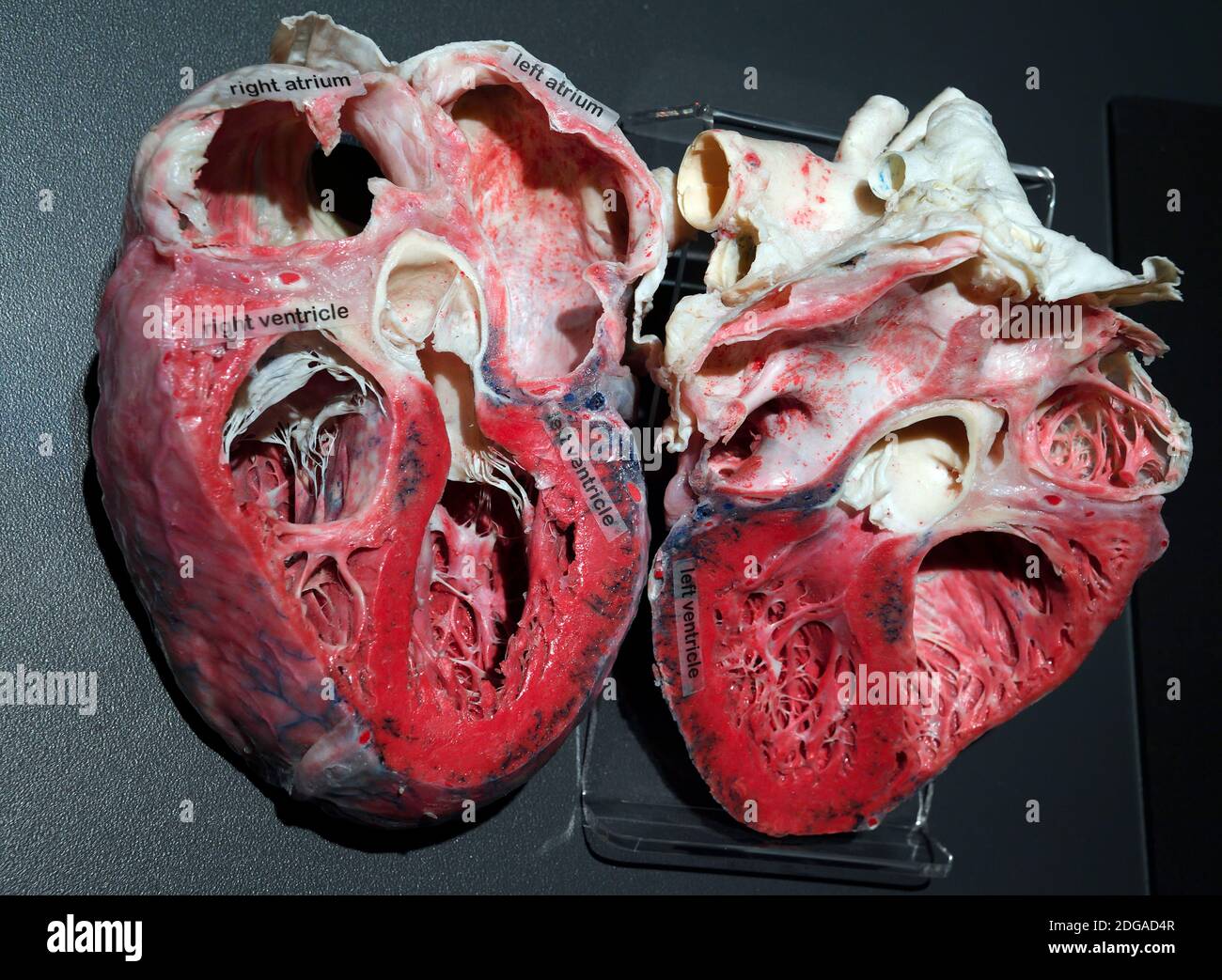Präparat, Plastinat, Querschnitt durch das menschliche Herz, Menschen Museum di Berlino, Deutschland Foto Stock