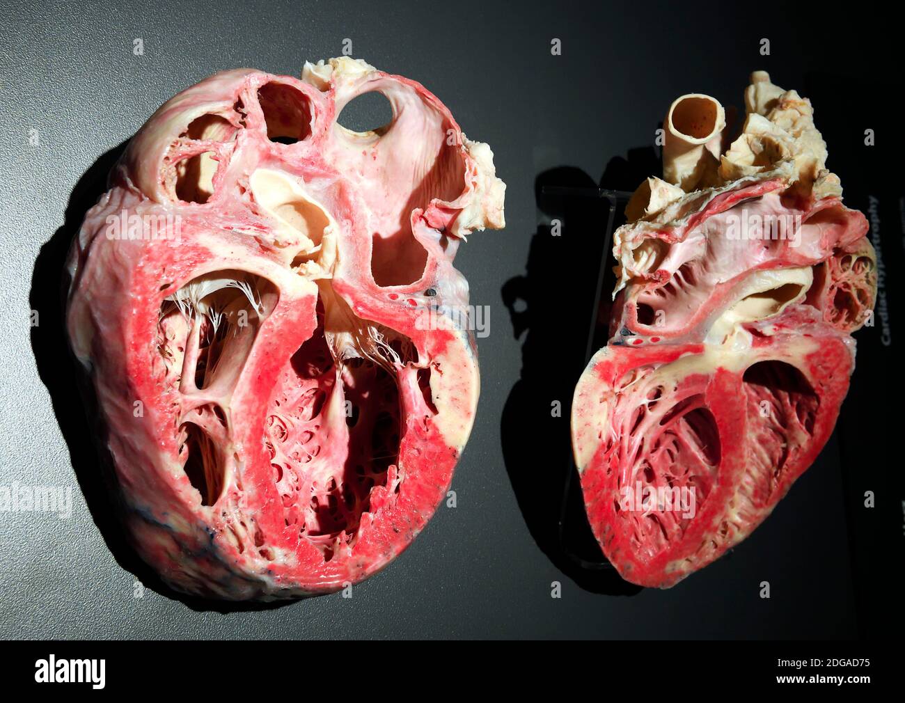 Präparat, Plastinat, Stark vergrößertes menschliches Herz, Menschen Museum di Berlino, Deutschland Foto Stock
