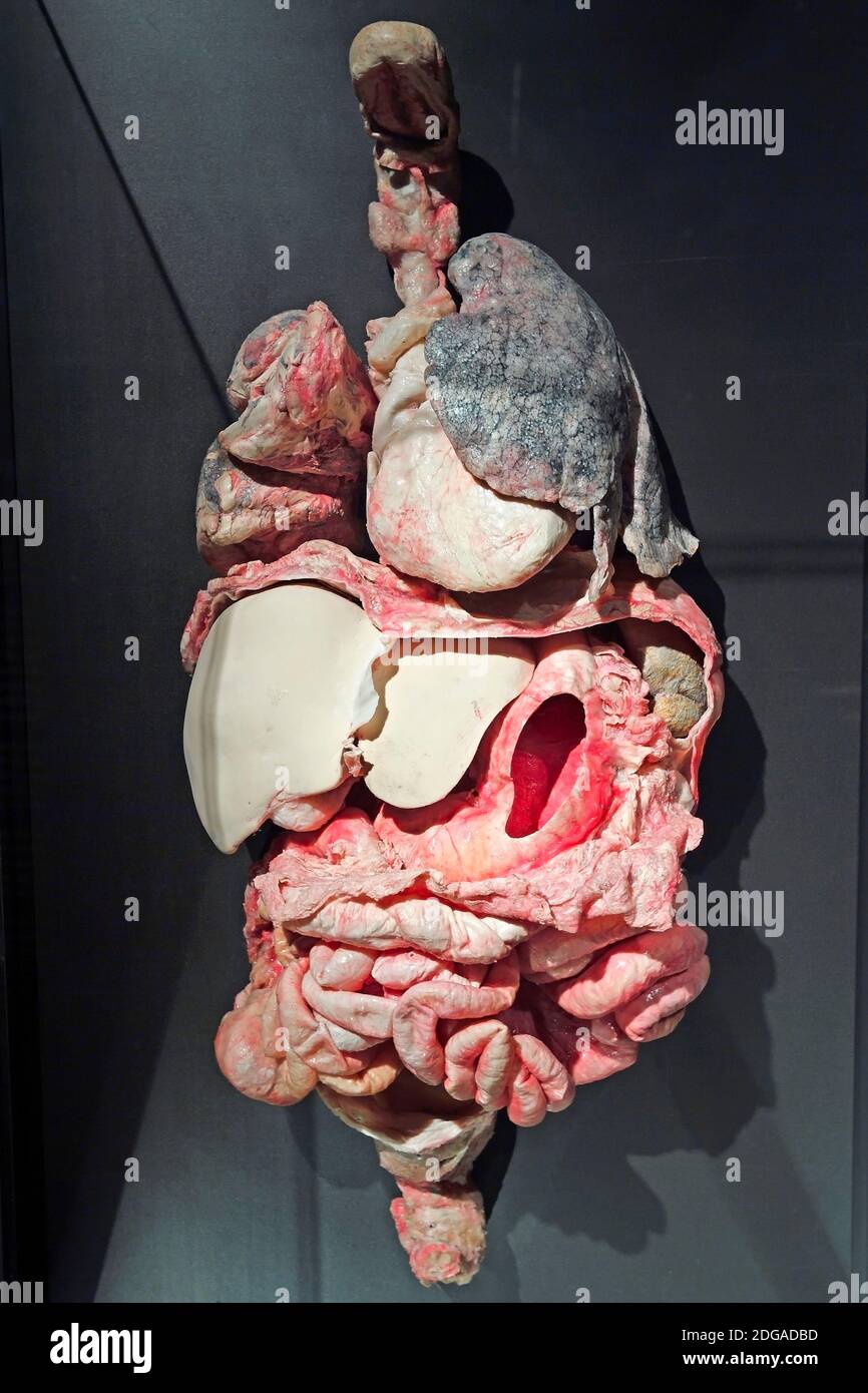 Präparat, Plastinat, innere Organe mit Raucherlunge, Menschen Museum di Berlino, Deutschland Foto Stock