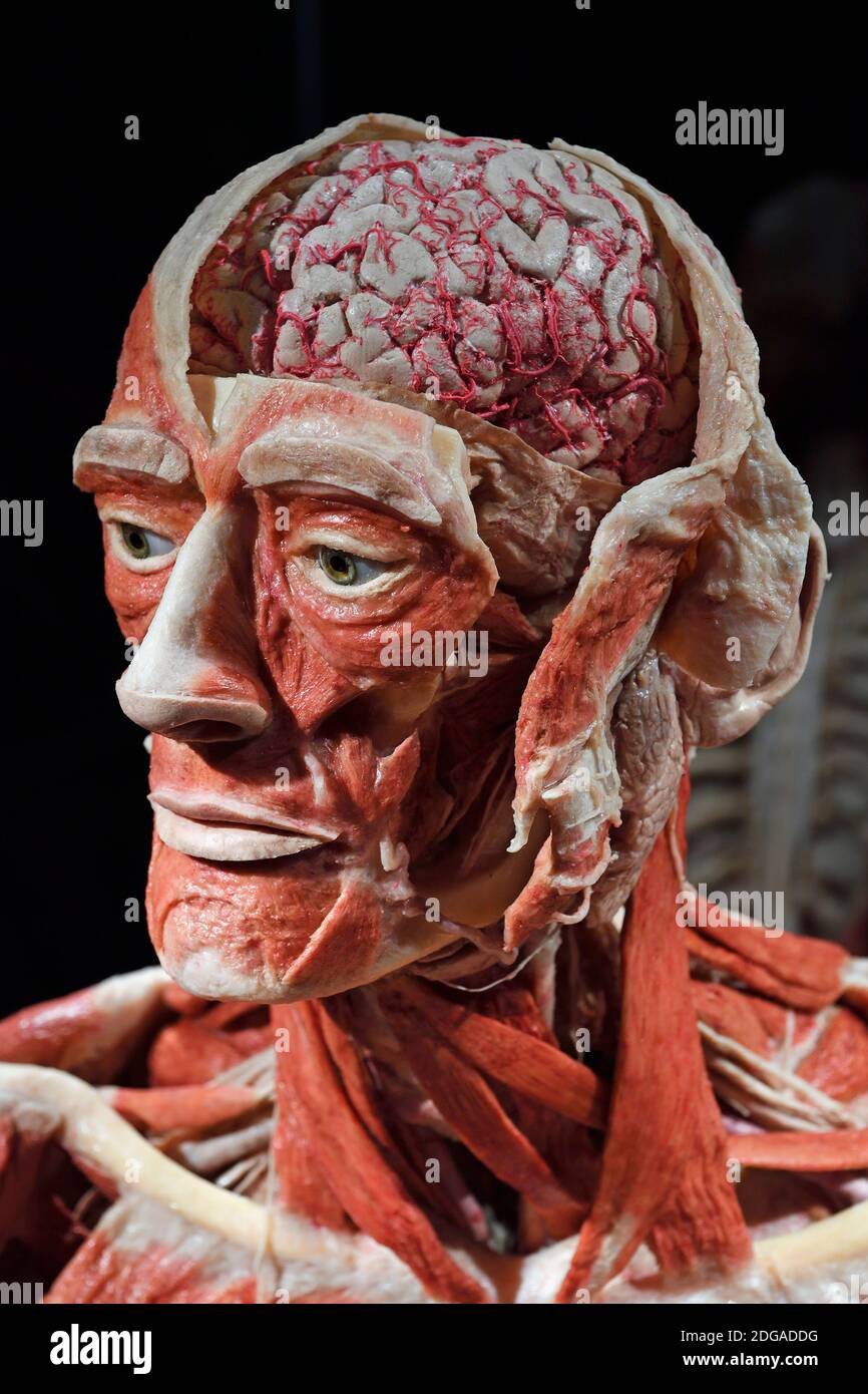 Präparat, Plastinat, eröffneter Kopf eines Mannes, Menschen Museum di Berlino, Deutschland Foto Stock