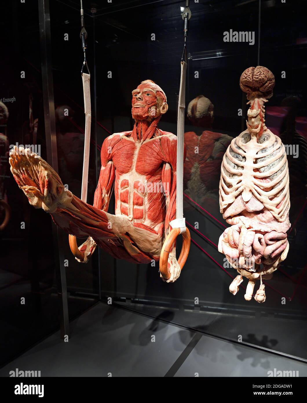 Präparat, Plastinat, Körper eines Mannes als Ringeturner, innere Organe , Menschen Museum di Berlino, Deutschland Foto Stock