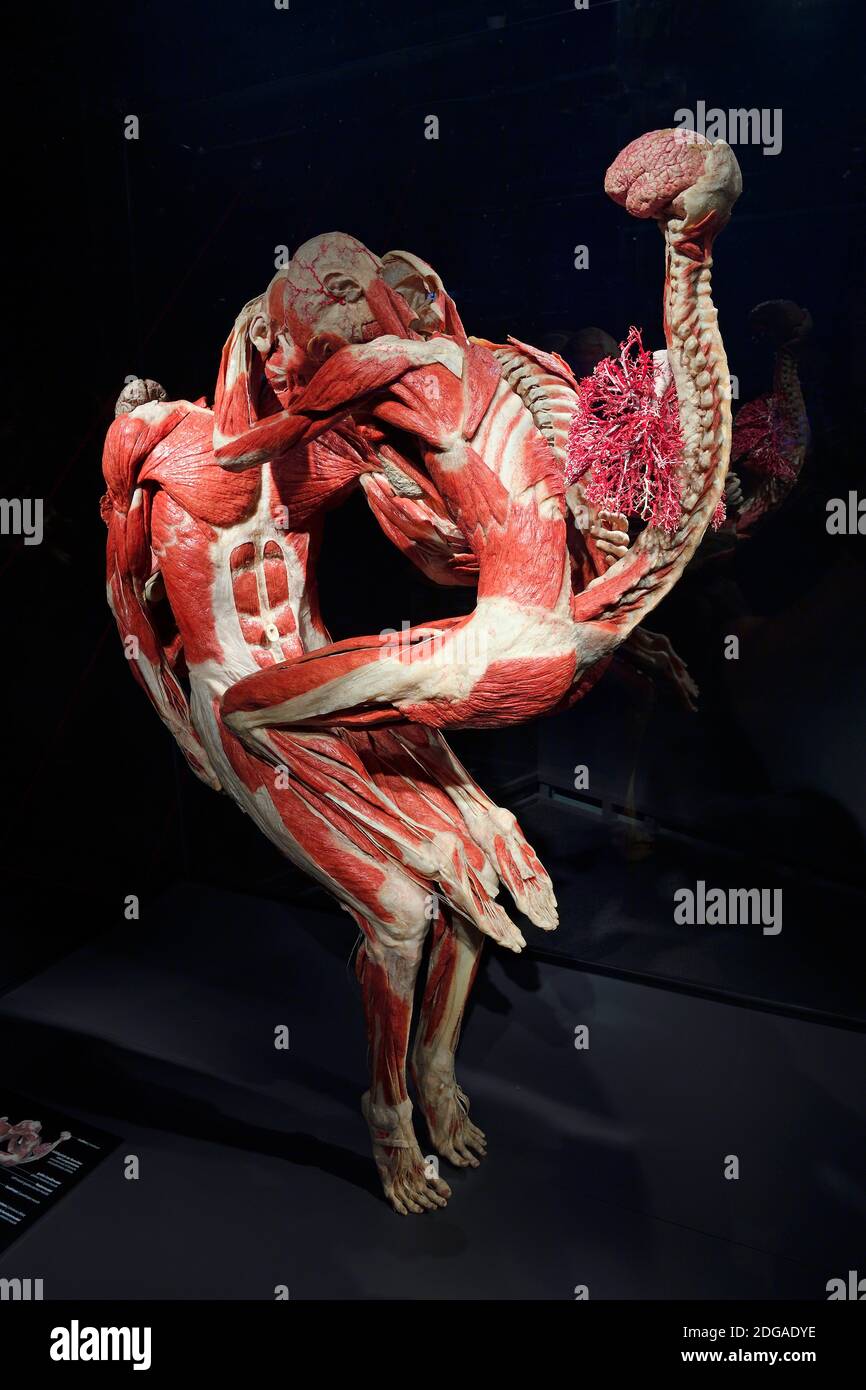 Präparat, Plastinat, umschlungenes Paar, Menschen Museum di Berlino, Deutschland Foto Stock