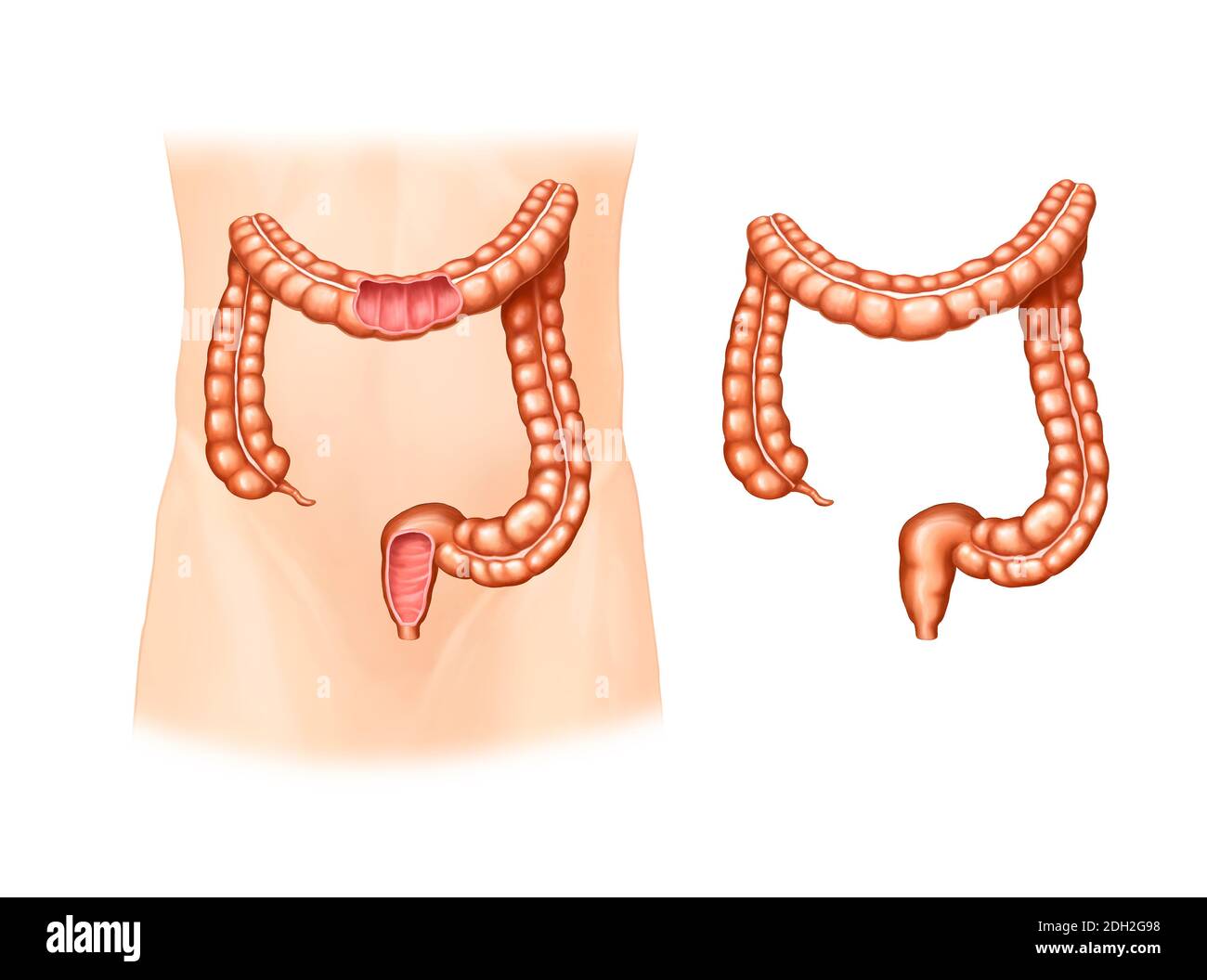 diagrammi anatomici dell'intestino crasso Foto Stock