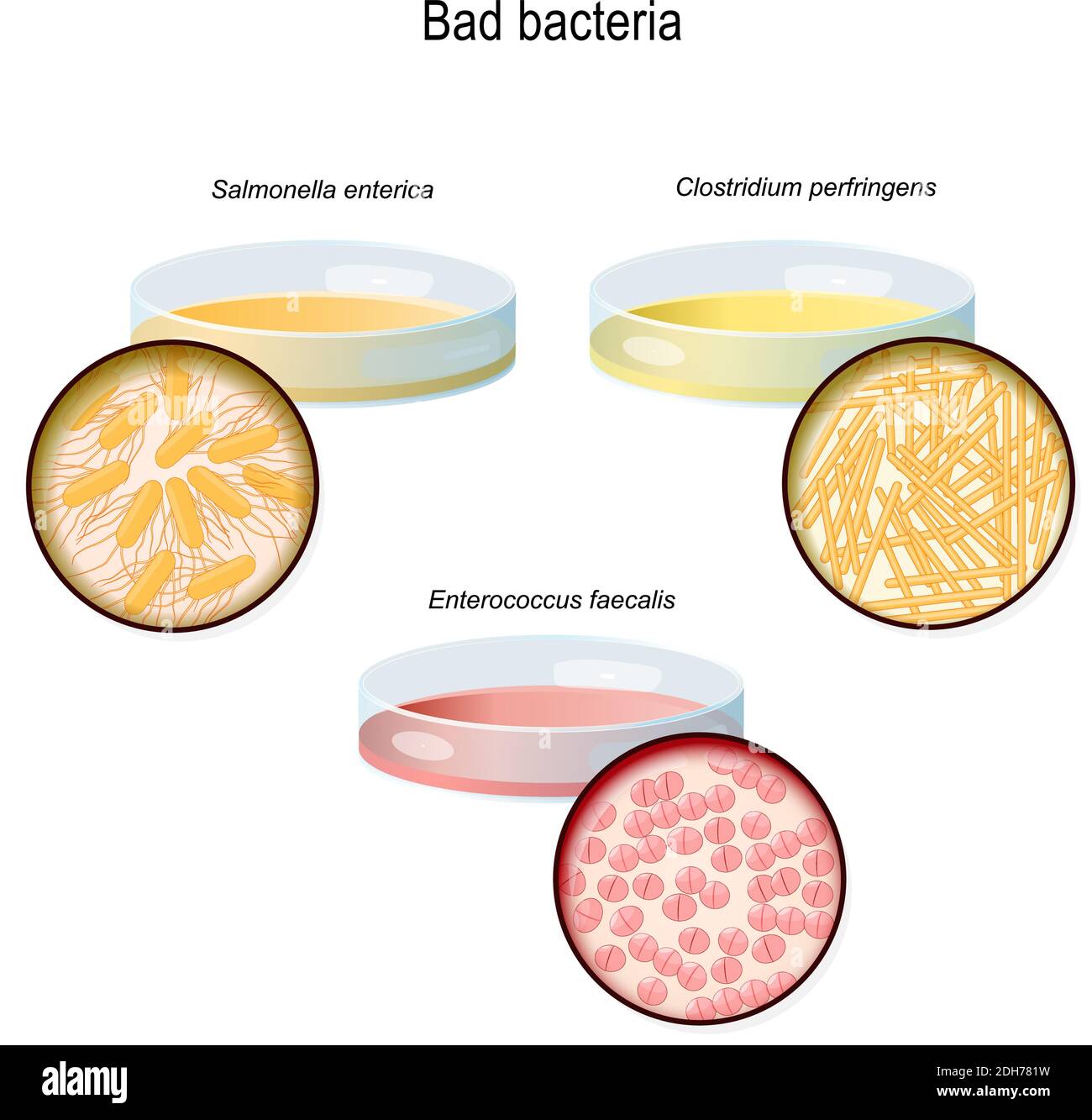 Una capsula di Petri con colonie batteriche. Flora intestinale. Primo piano di batteri cattivi: Clostridium perfringens, Enterococcus faecalis e Salmonella enterica Illustrazione Vettoriale