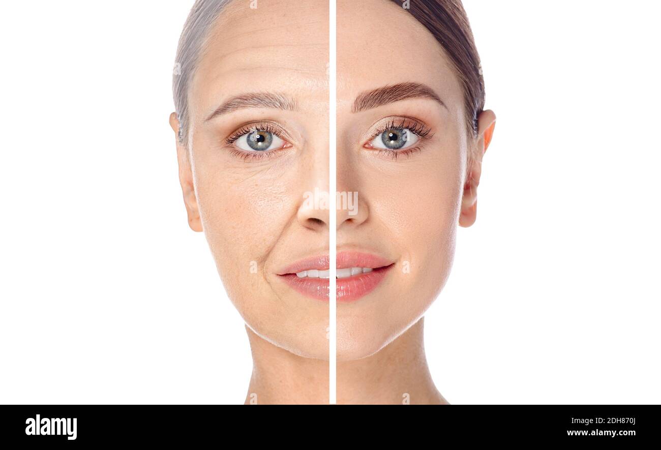 Concetto di invecchiamento della pelle, ritratto. Prima e dopo, viso giovane e vecchio, processo di invecchiamento. Cosmetologia procedure anti-invecchiamento. Pelle liscia e rughe Foto Stock