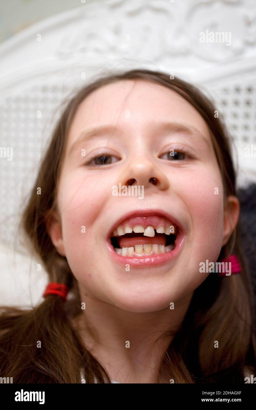 Giovane ragazza che perde il suo dente del bambino Foto Stock