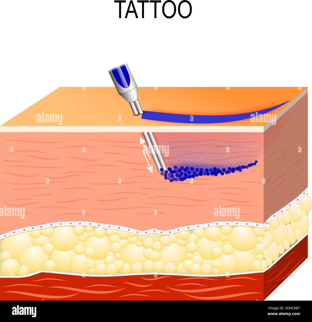 Processo di tatuaggio. Comunemente eseguita utilizzando aghi che lasciano le particelle di inchiostro nella pelle. Il processo di tatuaggio provoca danni all'epidermide Illustrazione Vettoriale