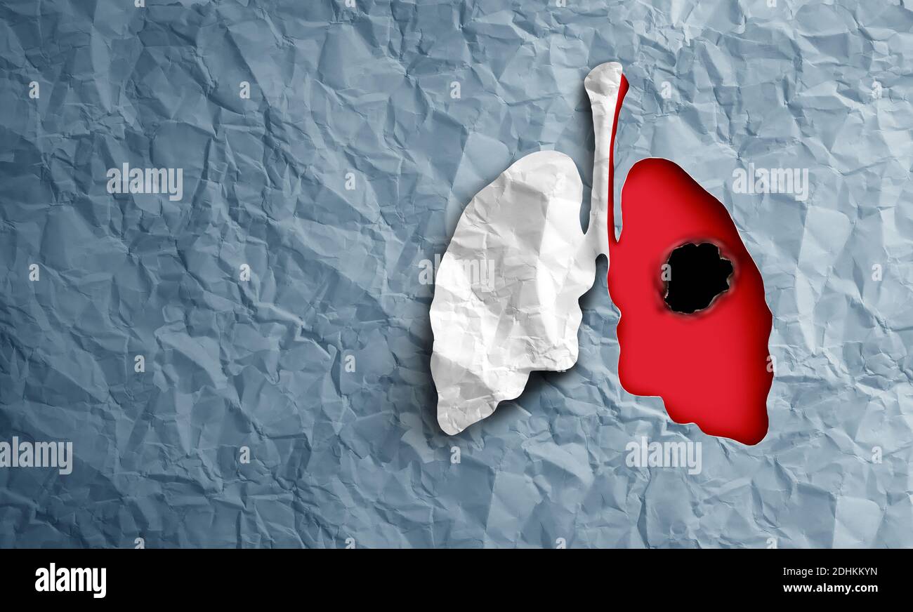 Diagnosi di cancro polmonare e concetto di sintomi di malattia dei polmoni umani come un declino della funzione respiratoria causato da un tumore in uno stile di illustrazione 3D. Foto Stock