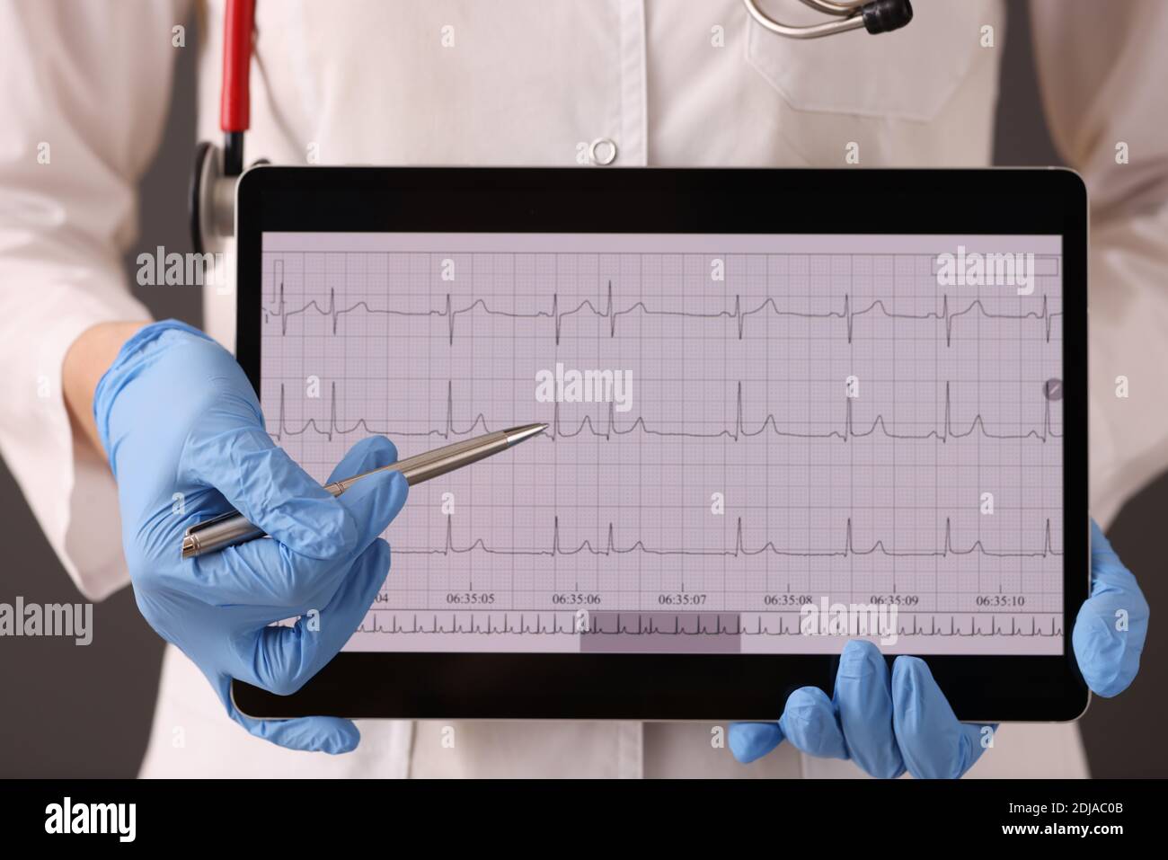 Medico in guanti di gomma che reggono compresse digitali con closeup del cardiogramma Foto Stock