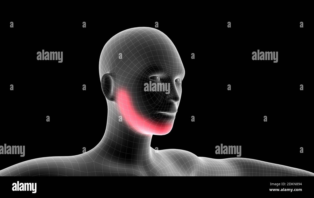 illustrazione 3d di un ologramma a raggi x della donna che mostra l'area del dolore sull'area della testa Foto Stock