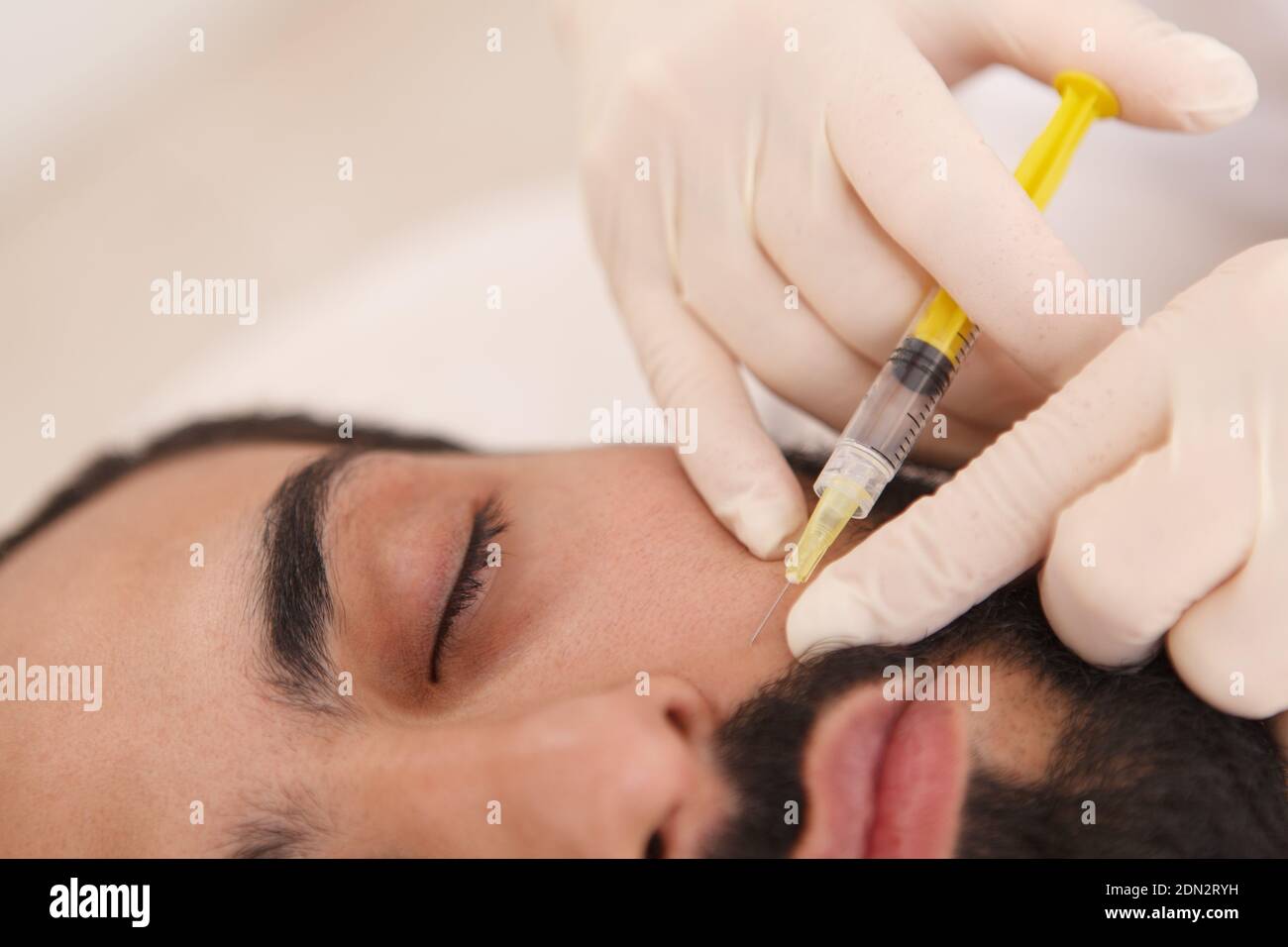 Primo piano di un estetista che inietta il riempitivo nelle grinze di un cliente di sesso maschile Foto Stock