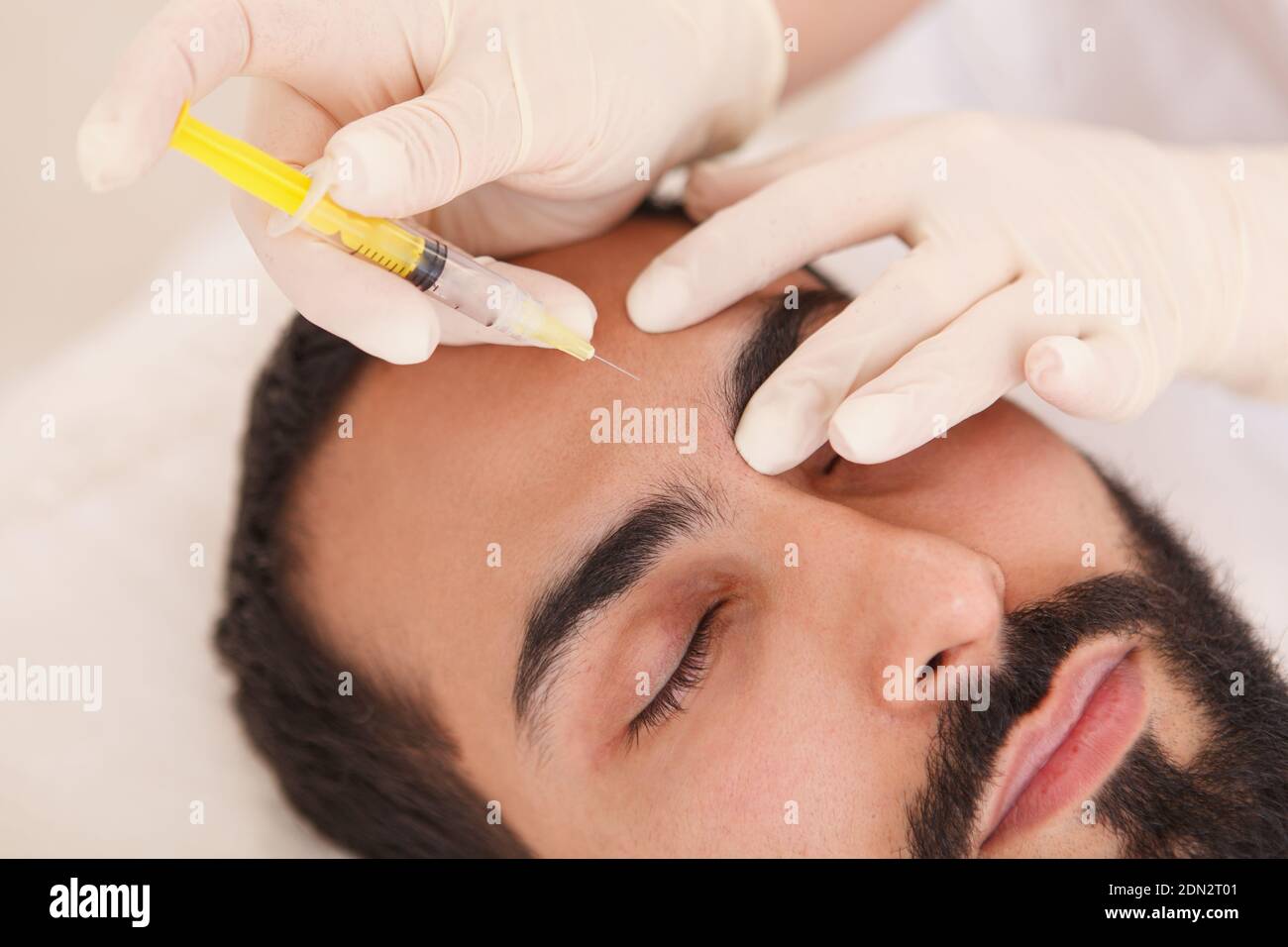 Primo piano ritagliato di un estetista che inietta il riempitivo facciale in rughe sulla fronte del cliente maschile Foto Stock