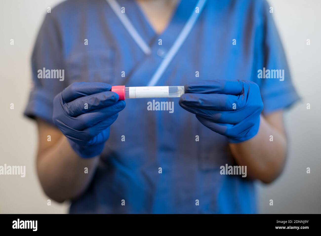 Lo scienziato tiene il campione medico nella provetta Foto Stock