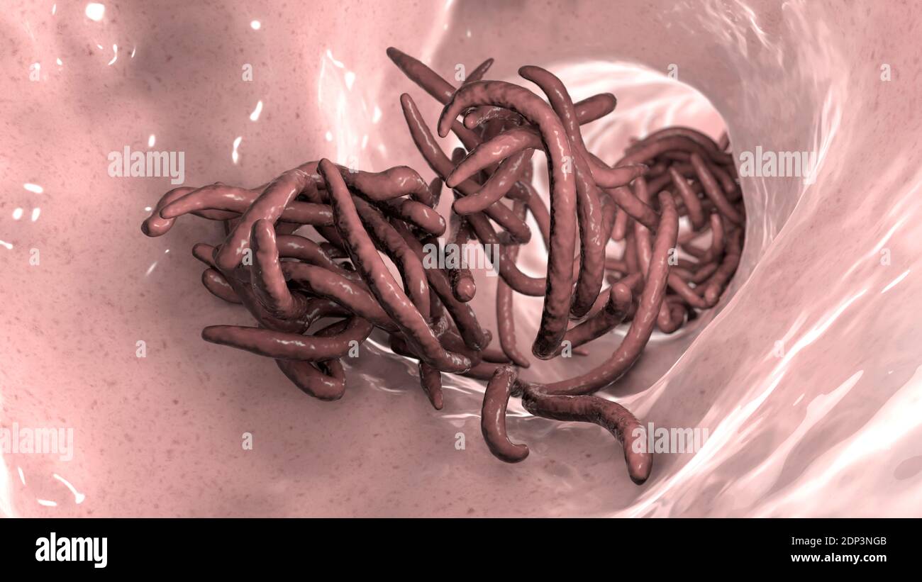 Vermi rotondi nell'intestino umano, illustrazione del computer. I worms rotonde, o nematodi, includono numerose specie viventi libere e patogeniche. Nematode che c Foto Stock