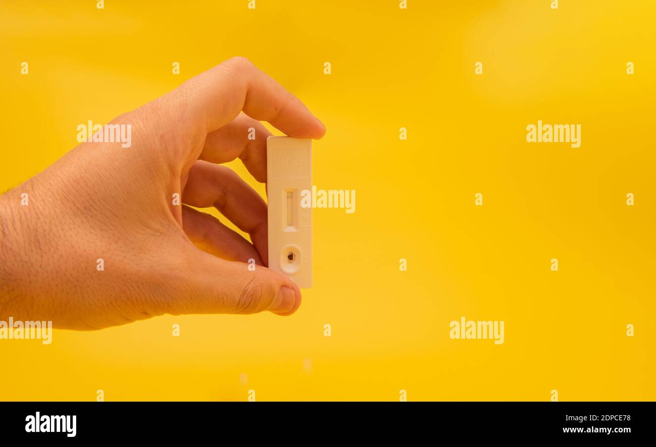 Mano maschio che mostra il test dell'antigene con risultato negativo su sfondo giallo. Foto Stock