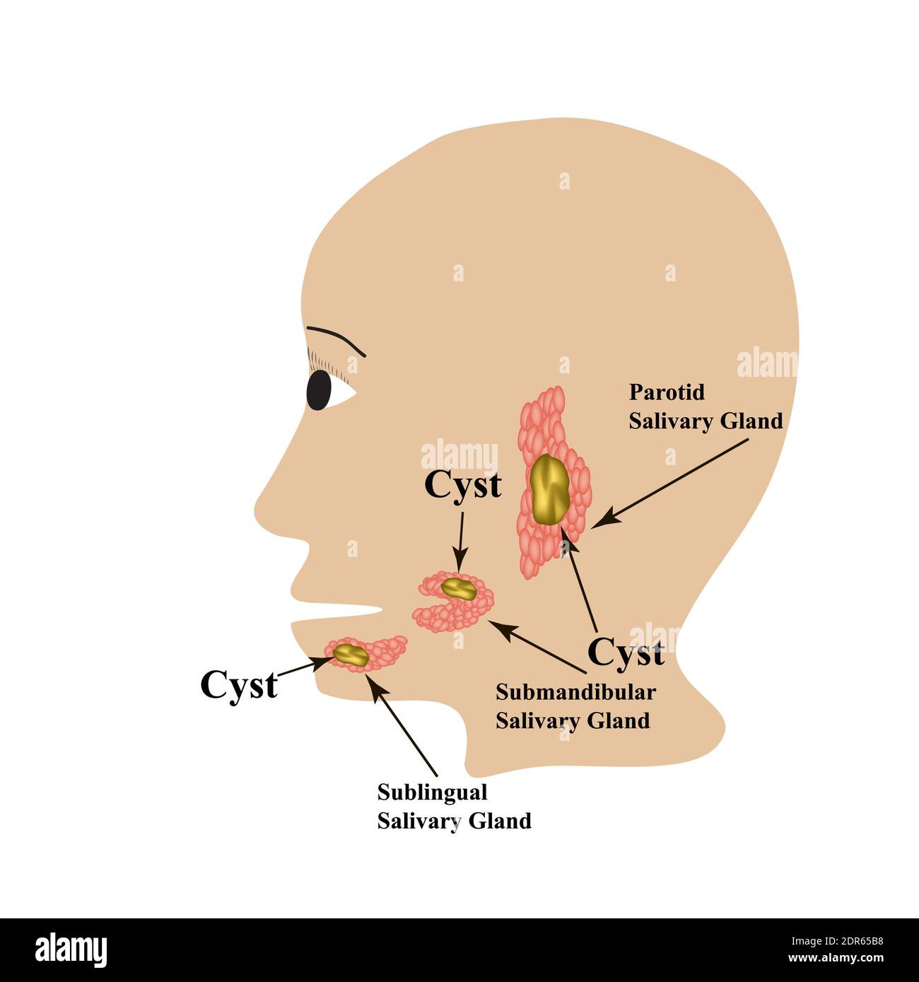 Ghiandola salivare parotide. Ghiandola salivare sottomandibolare. Ghiandola salivare sublinguale. Cisti. Illustrazione vettoriale su sfondo isolato Illustrazione Vettoriale