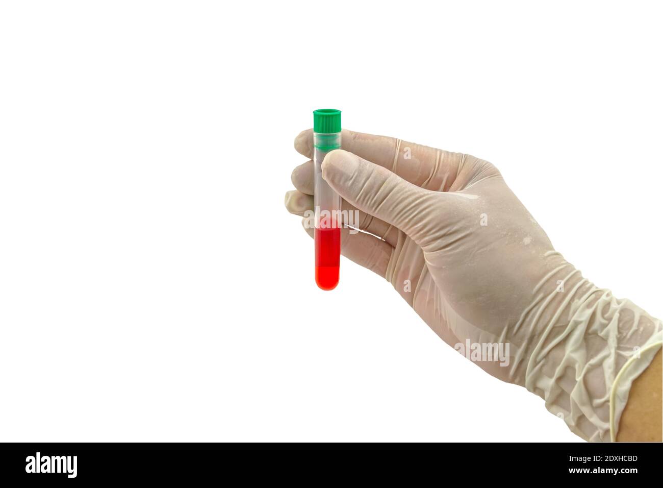 Medico che tiene un flacone di campione di sangue isolato su sfondo bianco.salvato con il tracciato di ritaglio. Foto Stock