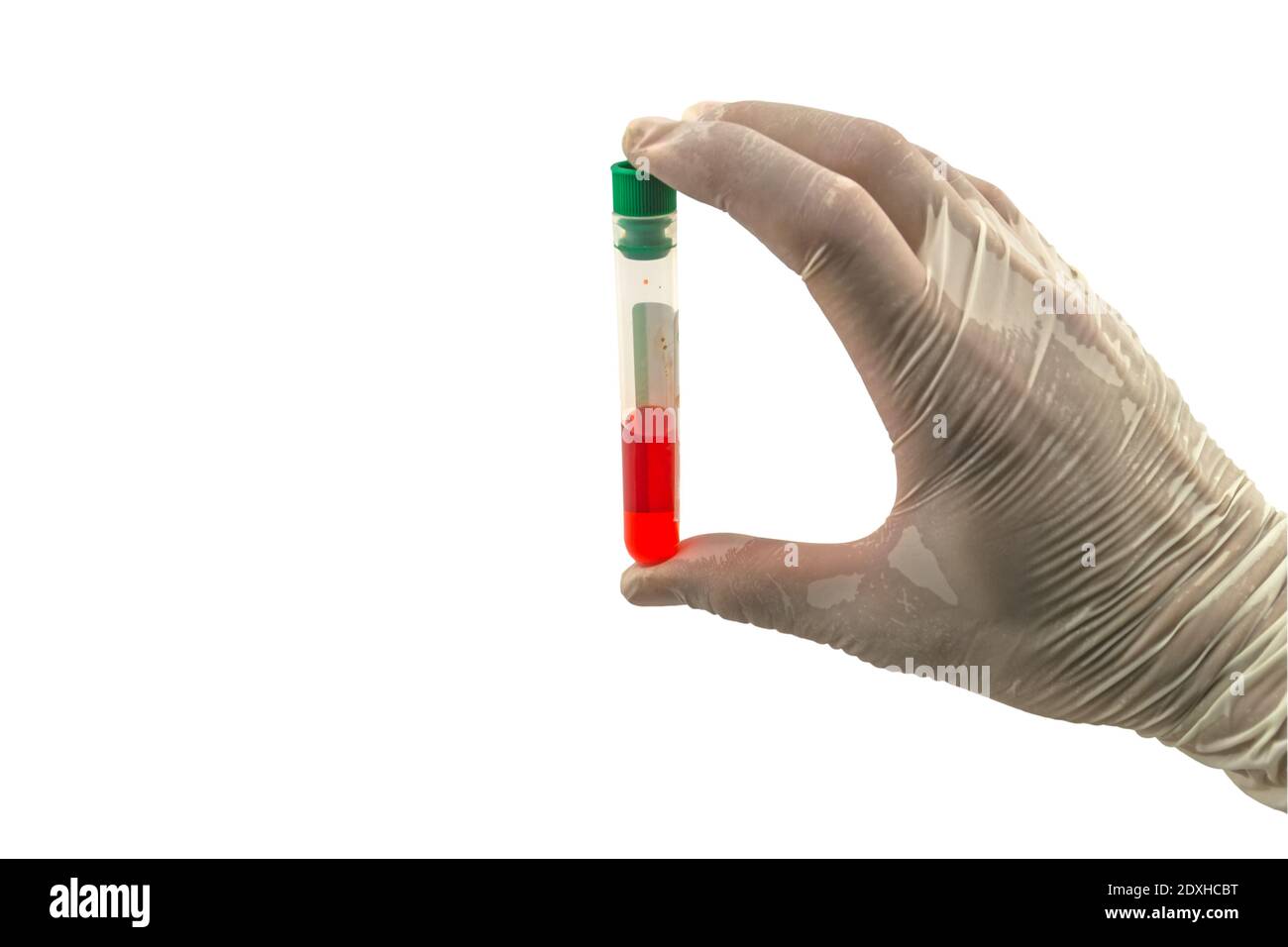 Medico che tiene un flacone di campione di sangue isolato su sfondo bianco.salvato con il tracciato di ritaglio. Foto Stock