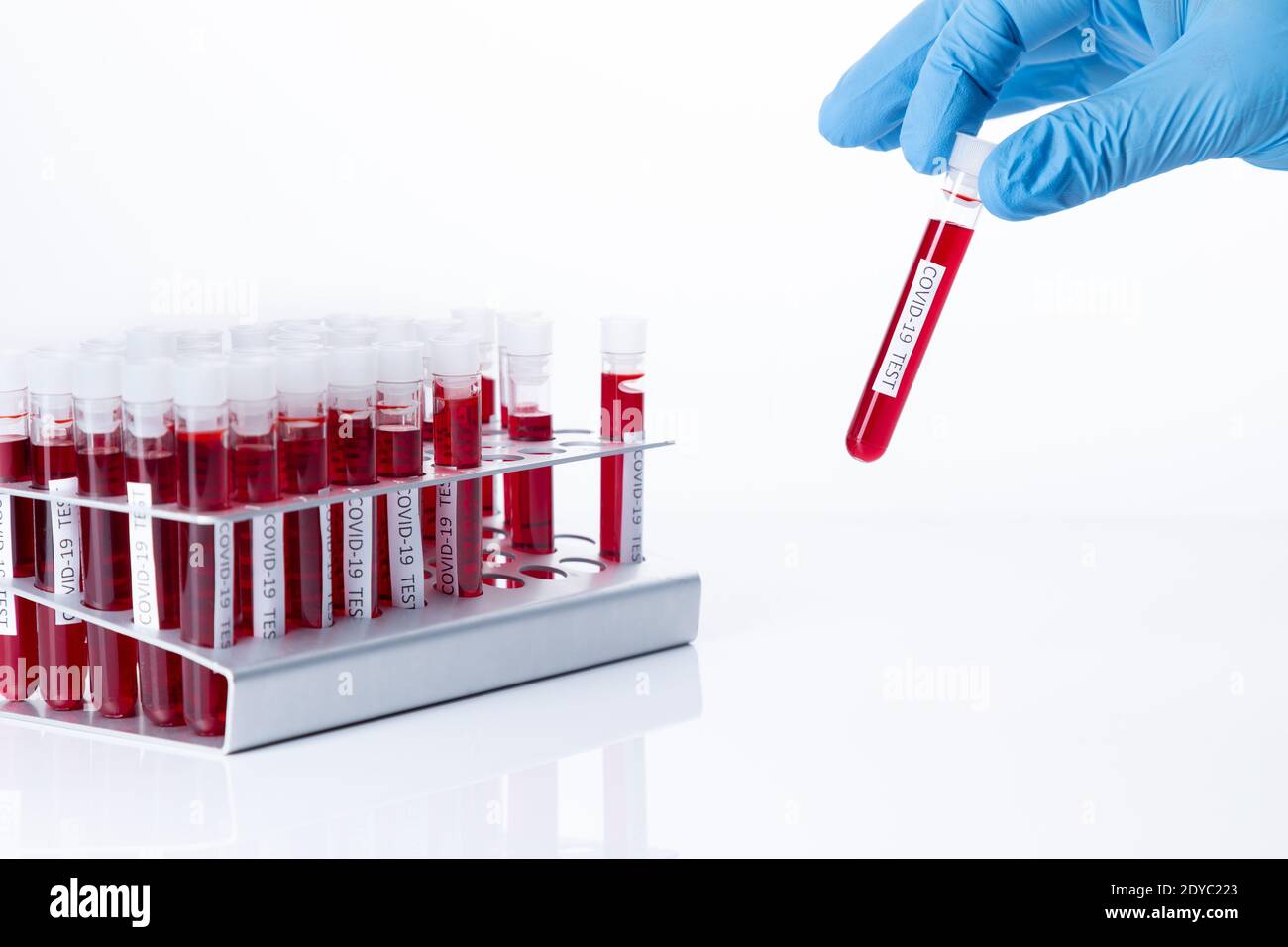 Provette per il test dell'infezione da coronavirus. Covid-19 e pandemia globale Concept . Foto Stock