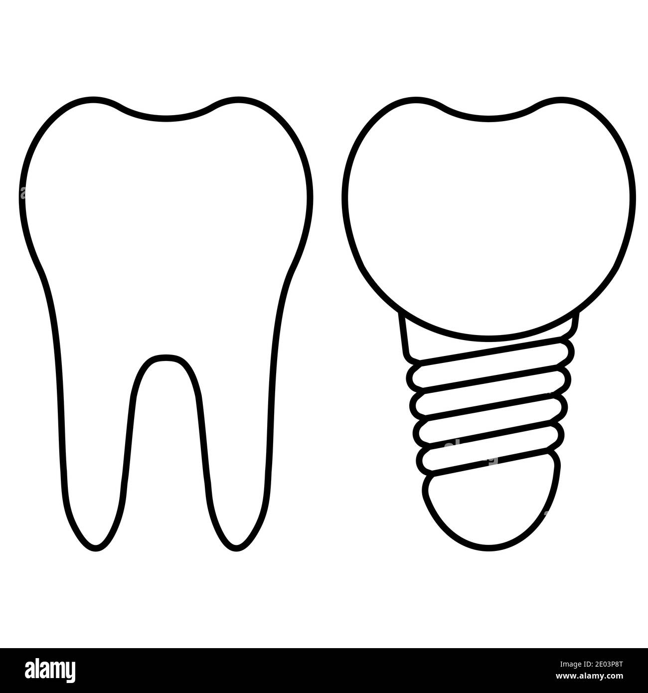 Chirurgia dentale. Taglio dell'impianto e dente sano. Corona di impianto dentale vettoriale realistica. Elementi stomatologici Illustrazione Vettoriale