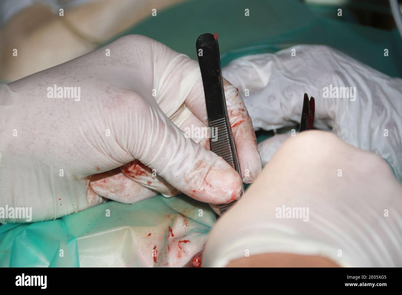 Un chirurgo veterinario rimuove un tumore da sotto la coda Di un cucciolo di Labrador Retiever Foto Stock