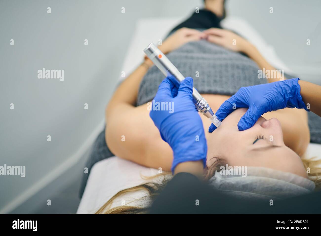 Cosmetologa non riconoscibile ritagliato in uniforme utilizzando penna  derma con micro aghi e pulizia viso del cliente in clinica di bellezza Foto  stock - Alamy