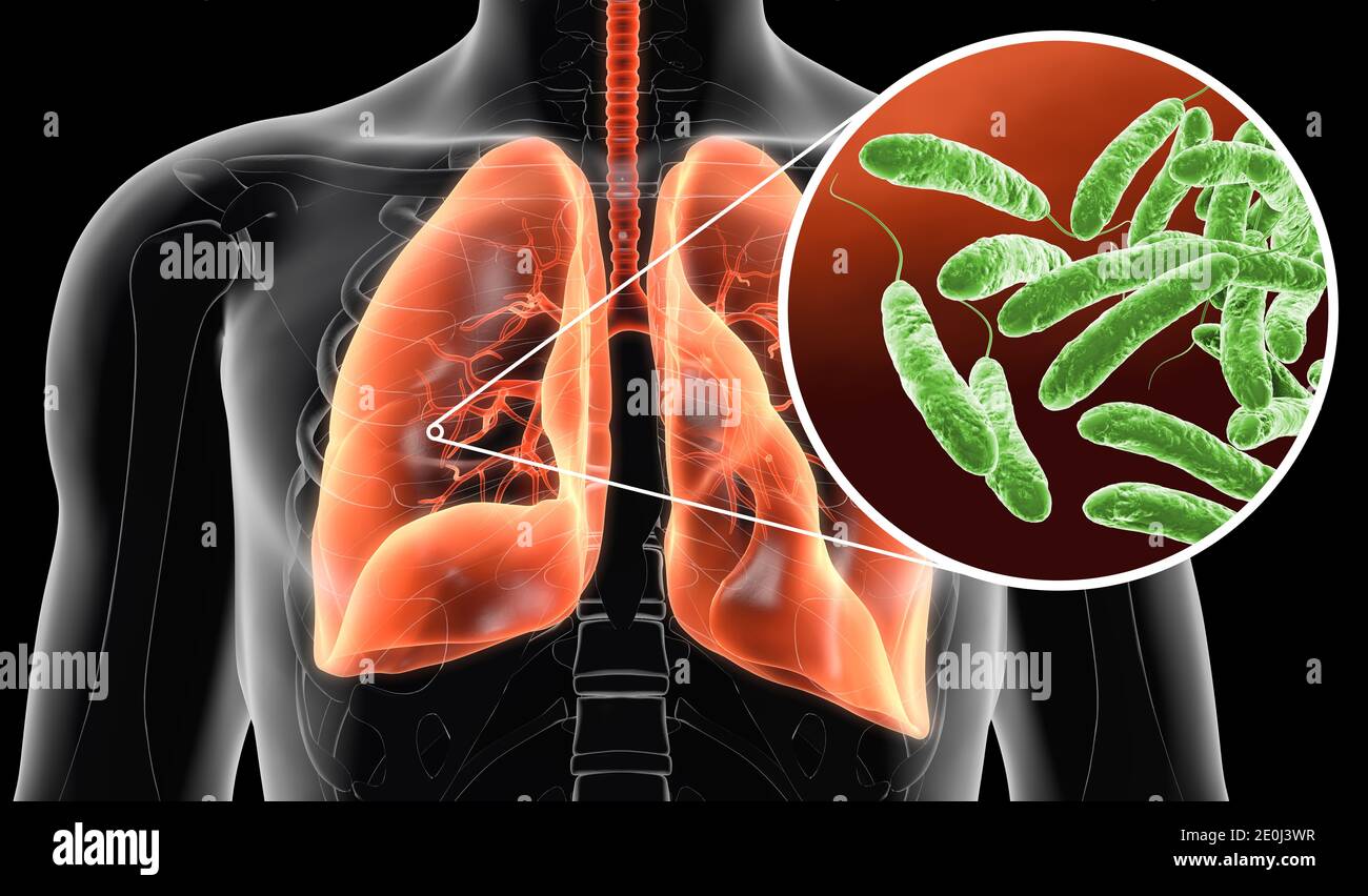 Illustrazione 3D che mostra i batteri della legionella pneumophila nei polmoni umani Foto Stock