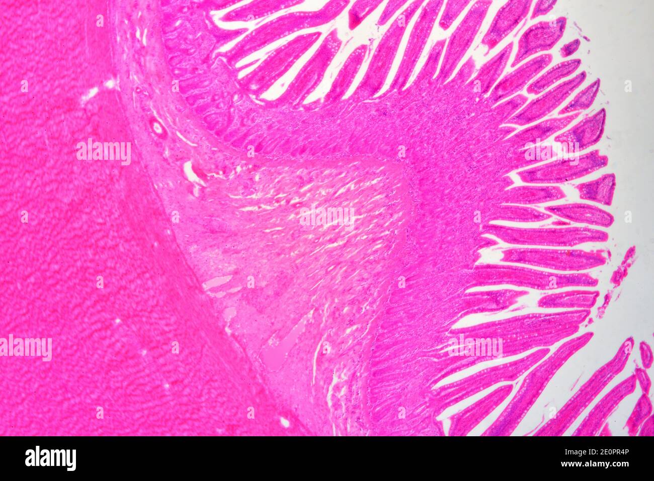Intestino tenue umano da sinistra a destra: Fibre muscolari (longitudinali e circolari), sottomucosa e mucosa con cripte di Lieberkhun. X25 a 10 Foto Stock